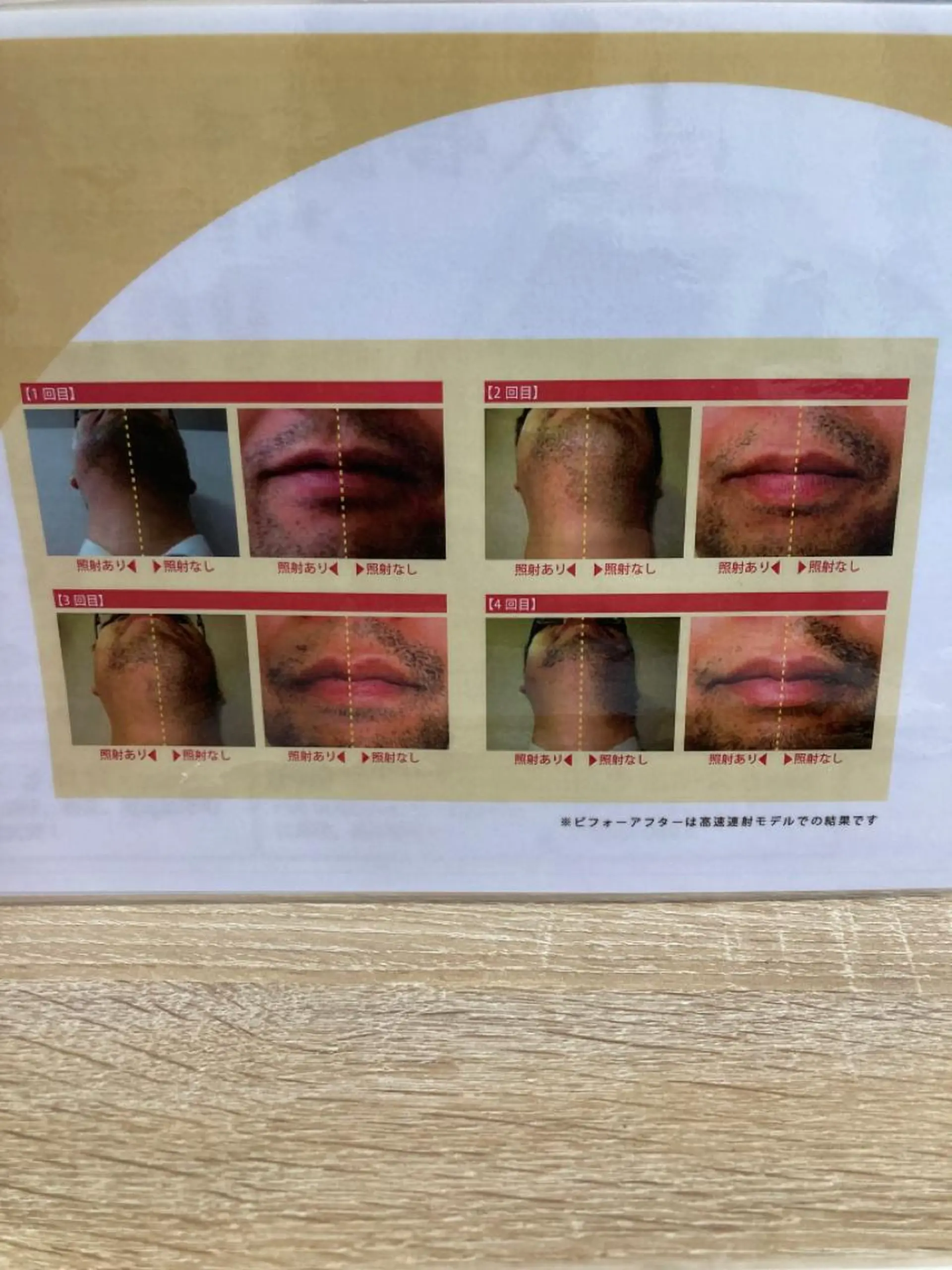 メンズ 矢野 つかさのマツエク・マツパデザイン