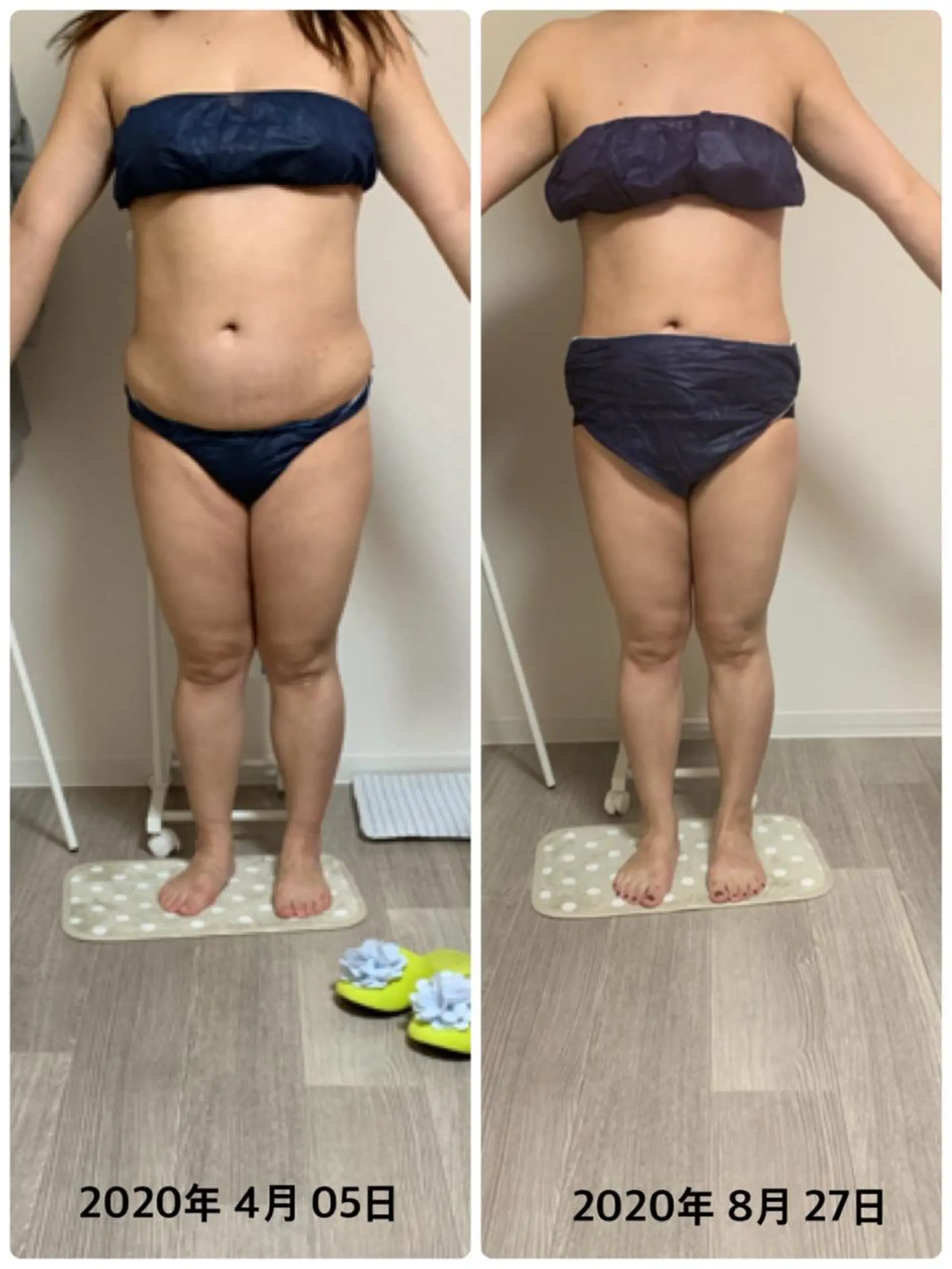 美ボディメイクサロン　only one body所属・所沢 痩身エステサロンのエステ・リラクイメージ