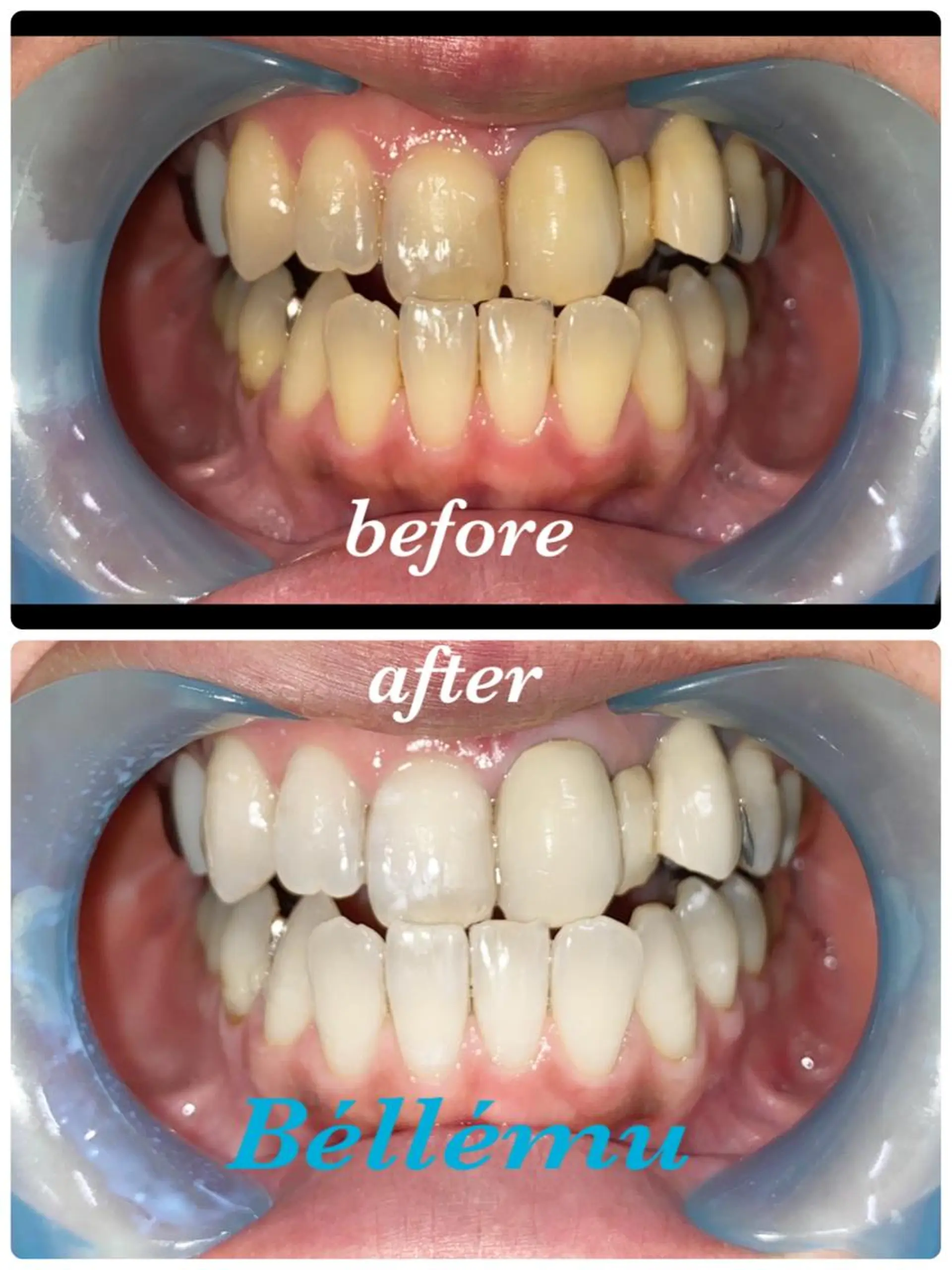 その他 Salon de Béllému所属・Béllému ﾍﾞﾙｴﾐｭ　あおいのエステ・リラクイメージ