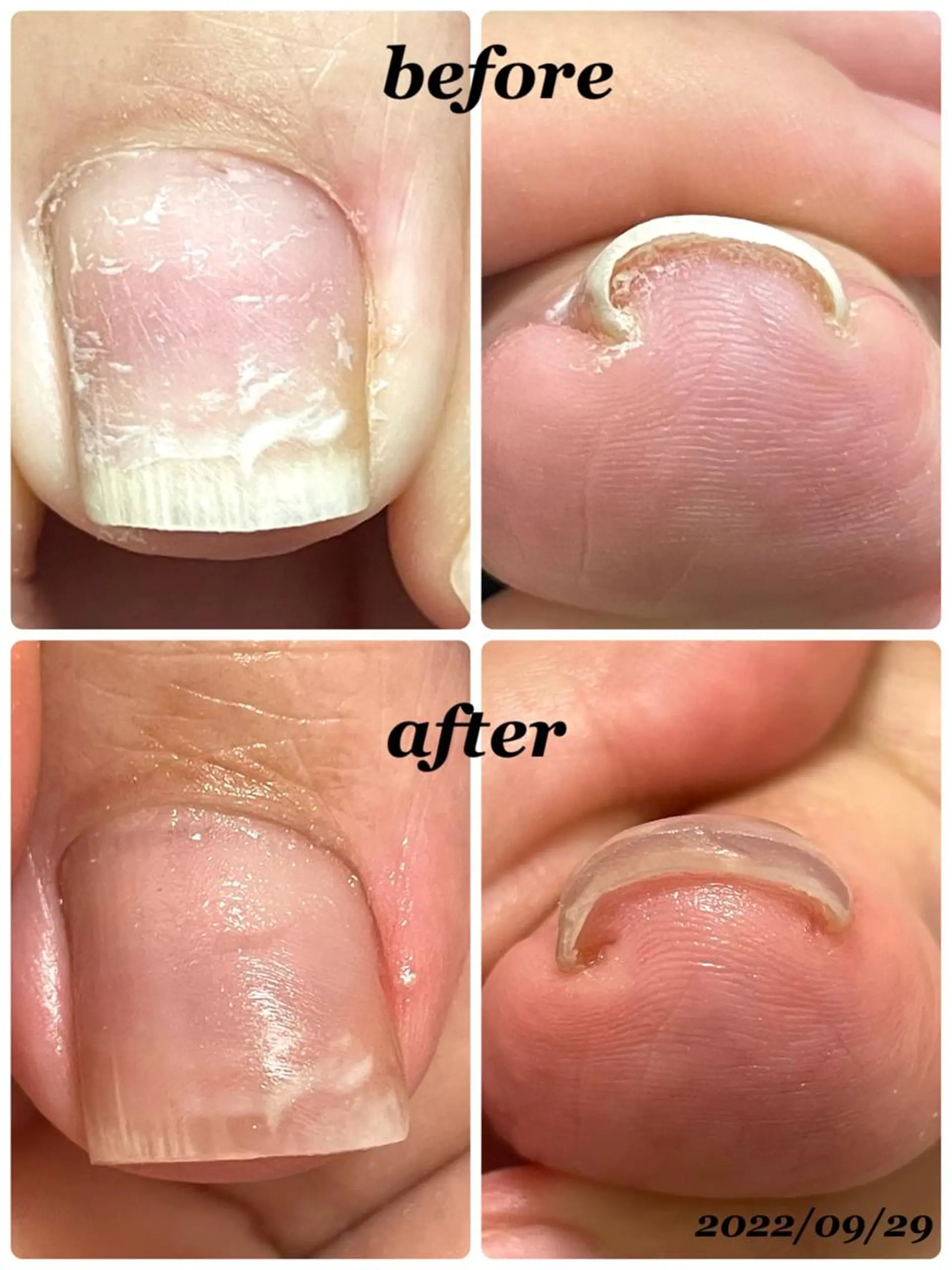 ネイル R*NAIL .comのネイルデザイン