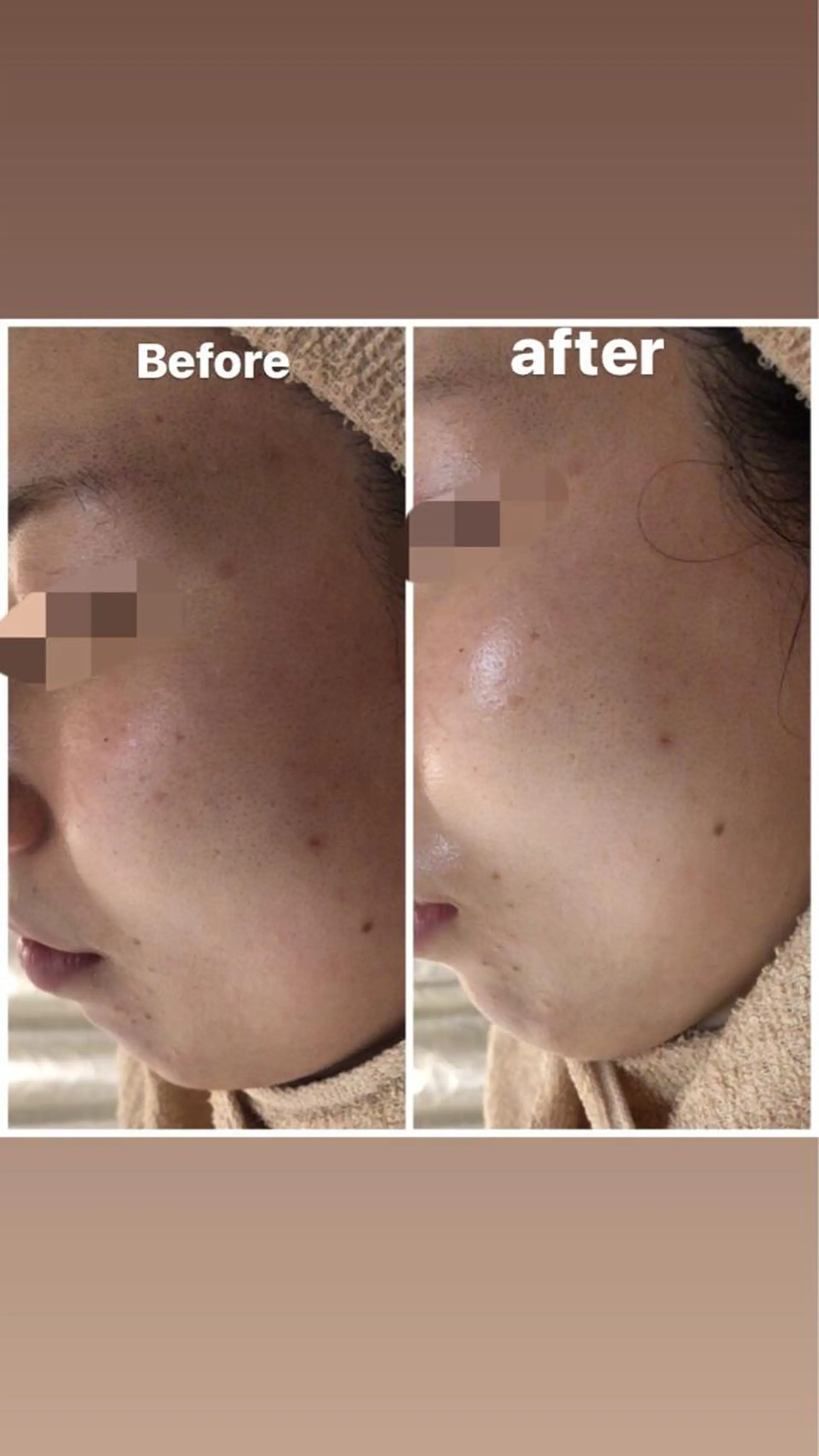 ショート カラー パーマ ヘアアレンジ メンズ キッズ ネイル マツエク・マツパ Amaryllis 🌹のエステ・リラクイメージ