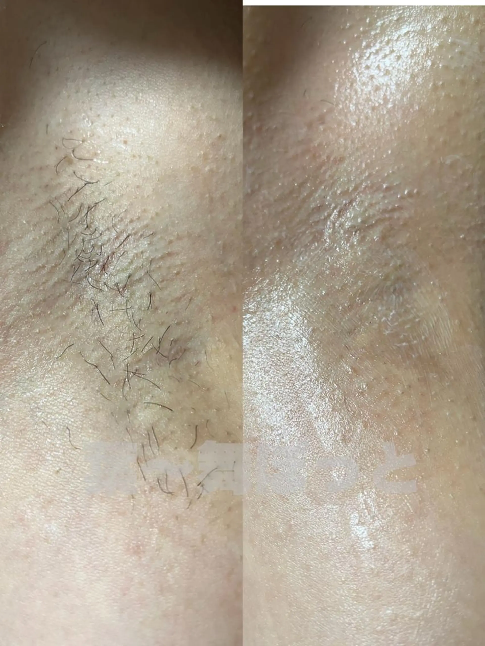 うえつま ふみえのエステ・リラクイメージ