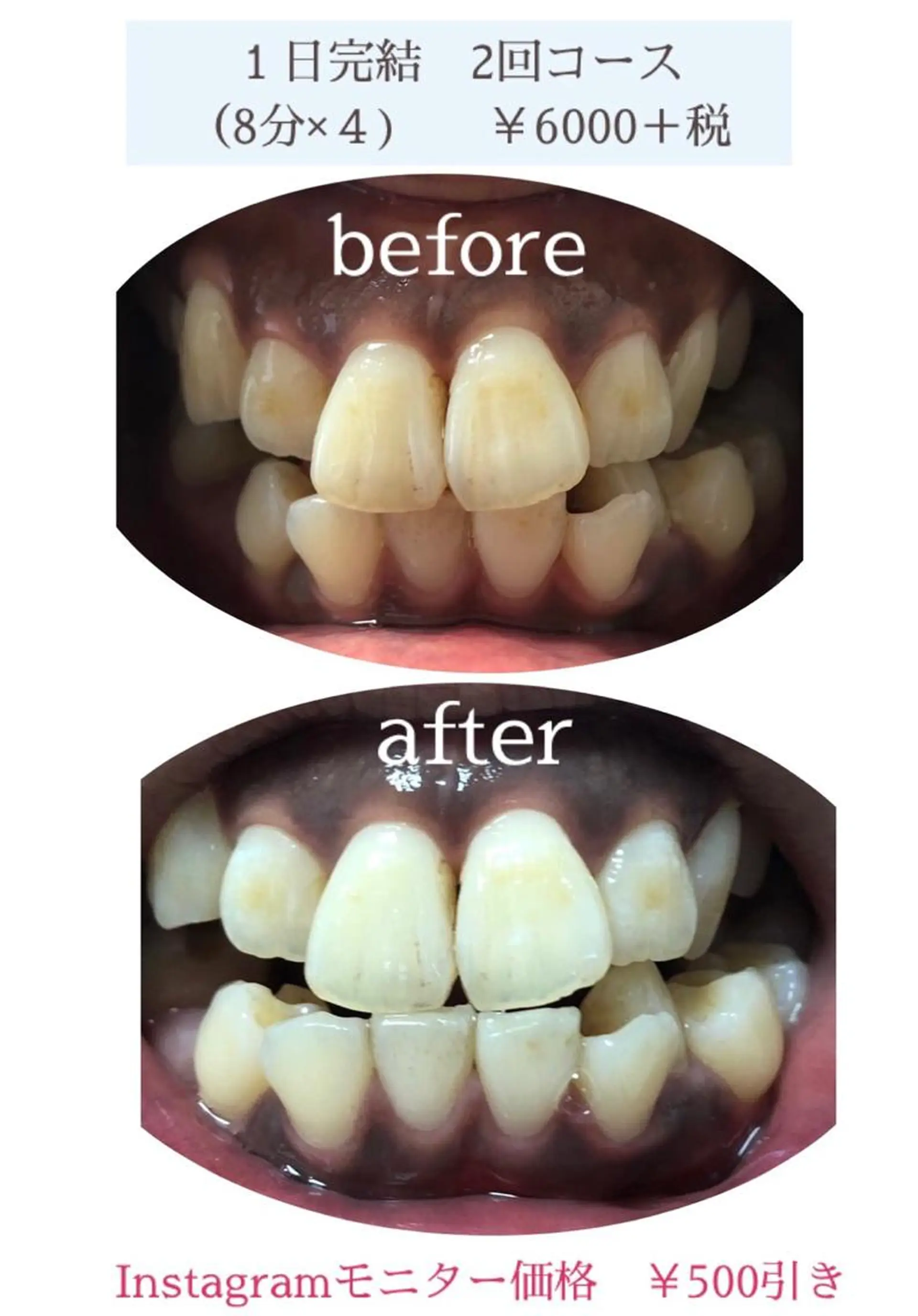 石谷 詩織のネイルデザイン