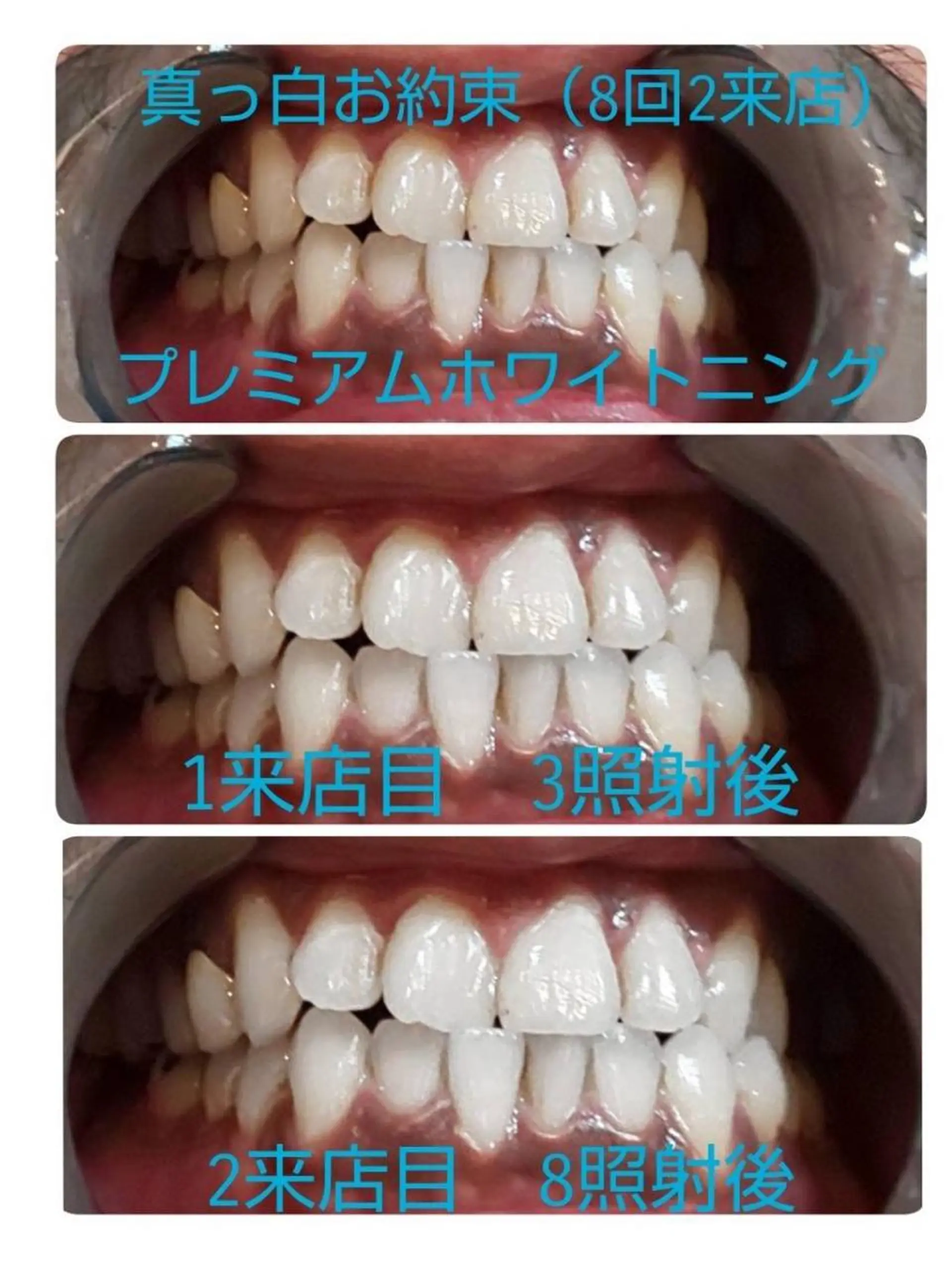 その他 ライトビューティー 恵比寿店のその他イメージ