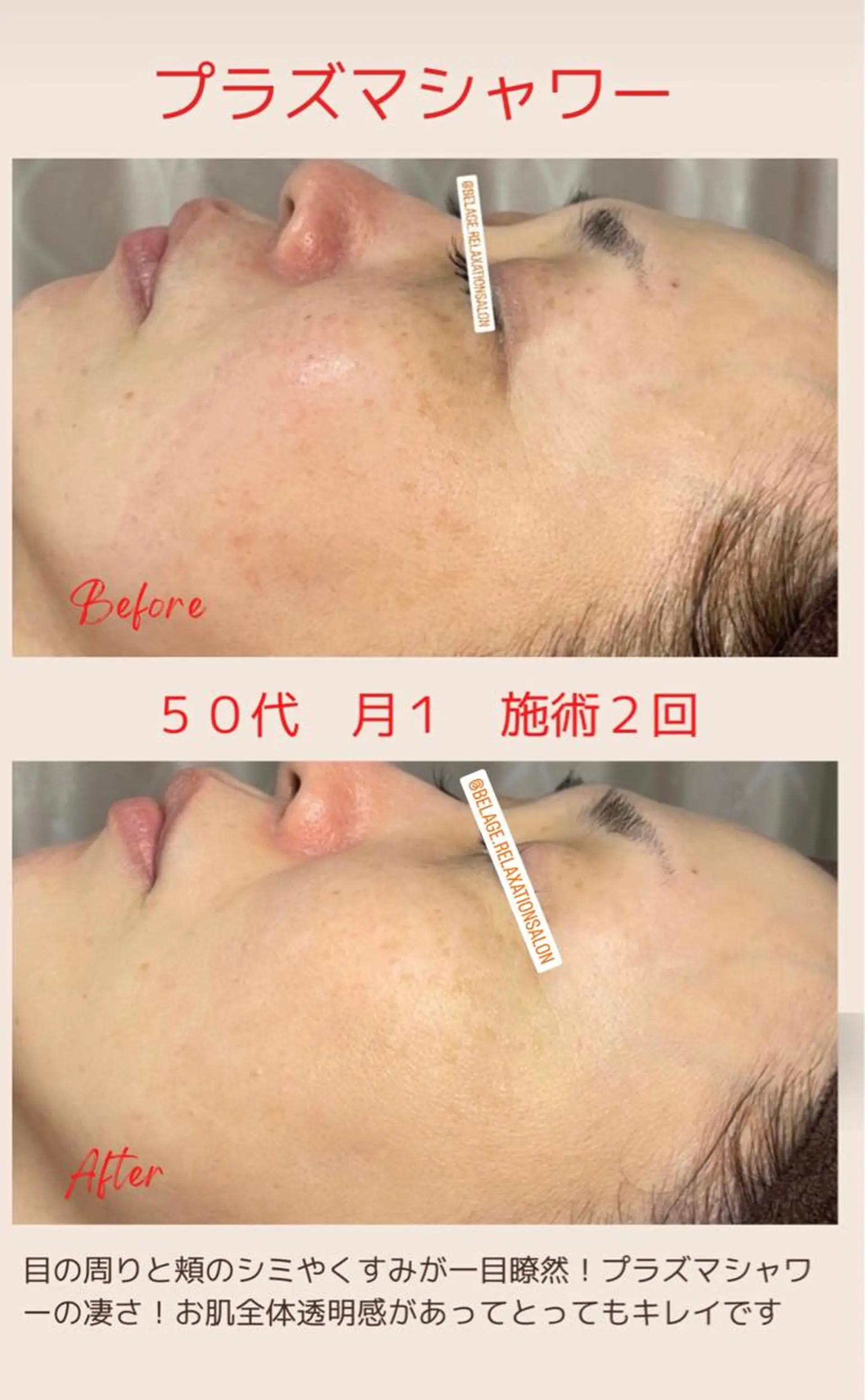 ベラージュ【美背中・ 美尻・フェイシャル】のエステ・リラクイメージ