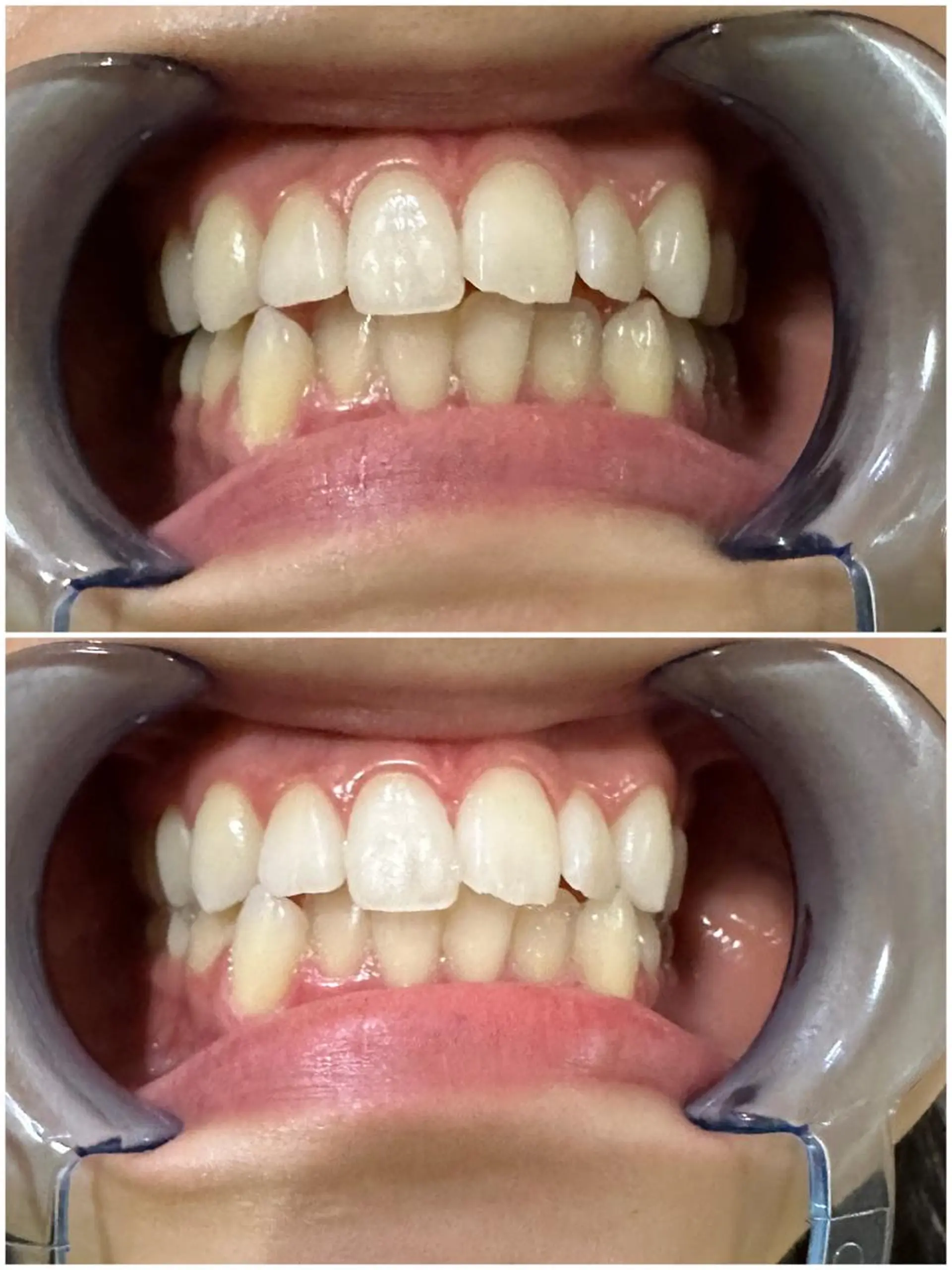 その他 ホワイトニングジム 池袋のその他イメージ