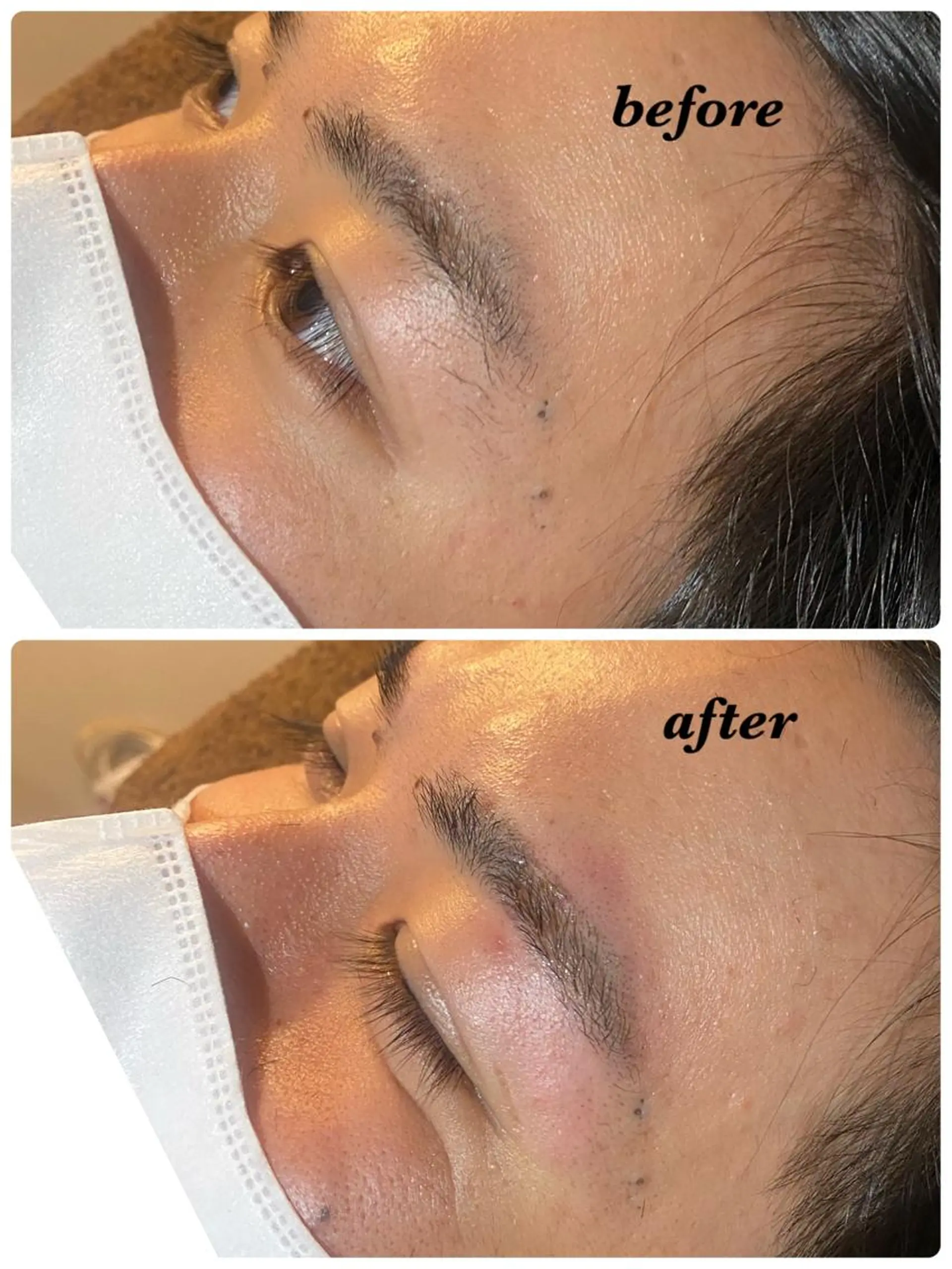 アイブロウ ハーブピーリング/韓国肌管理/フェイシャル/毛穴洗浄/眉毛/顔脱毛【糸脱毛専門】rev所属・ハーブピーリング🌹 毛穴洗浄❤️眉waxのエステ・リラクイメージ