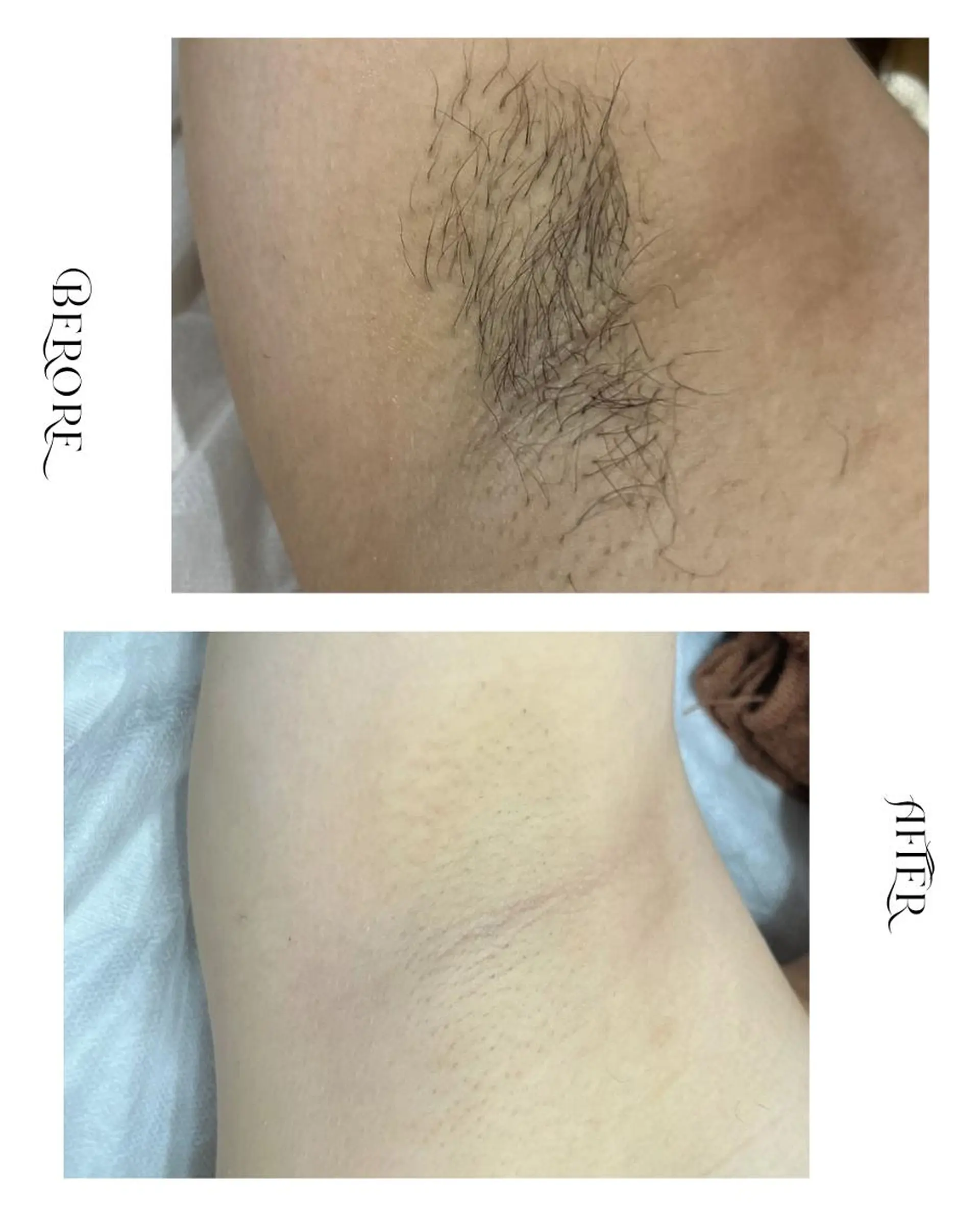 脱毛 脱毛・肌質改善サロン Linoのエステ・リラクイメージ