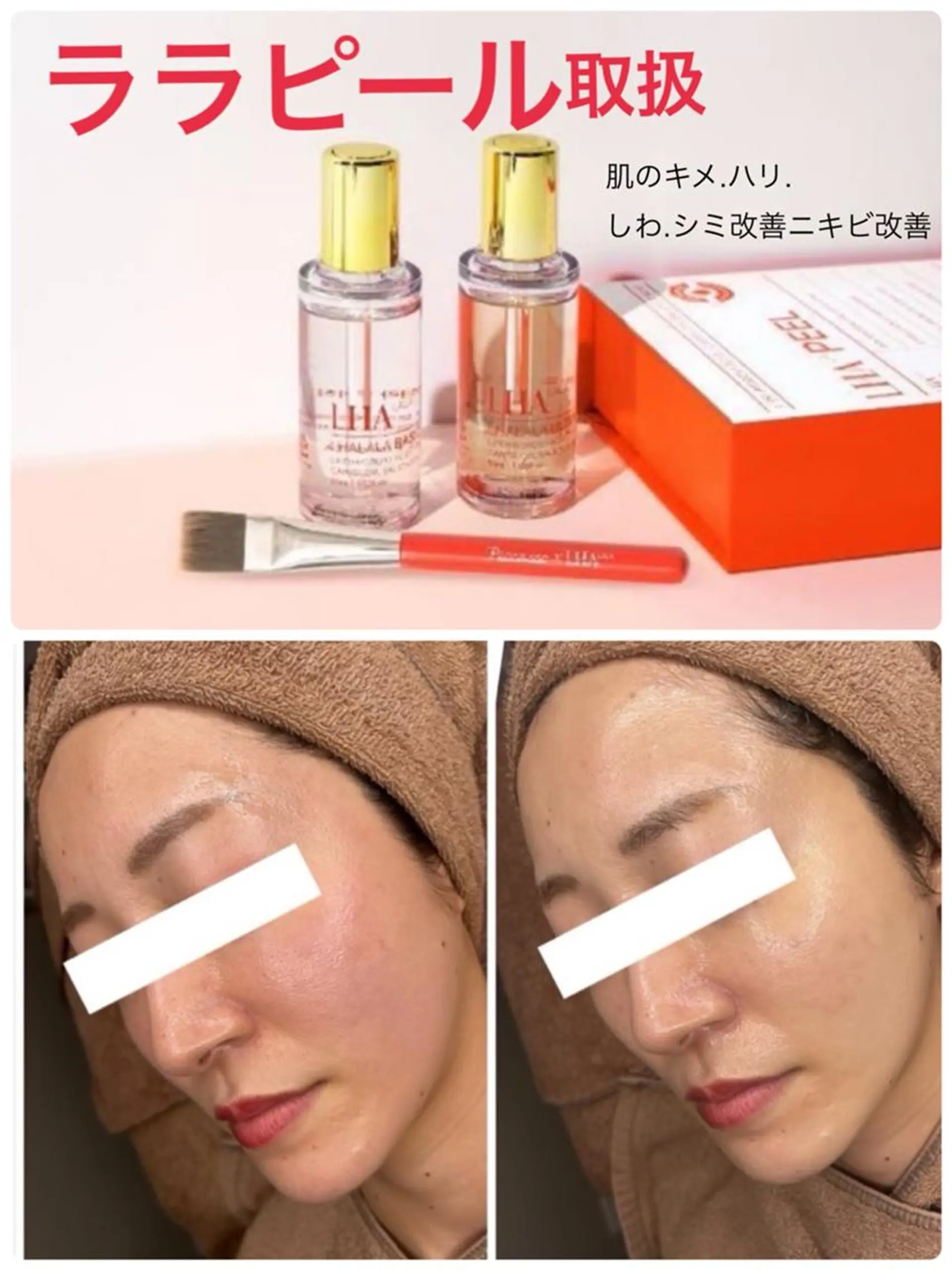 ネイル クロス ラニ 深爪矯正もお任せのネイルデザイン