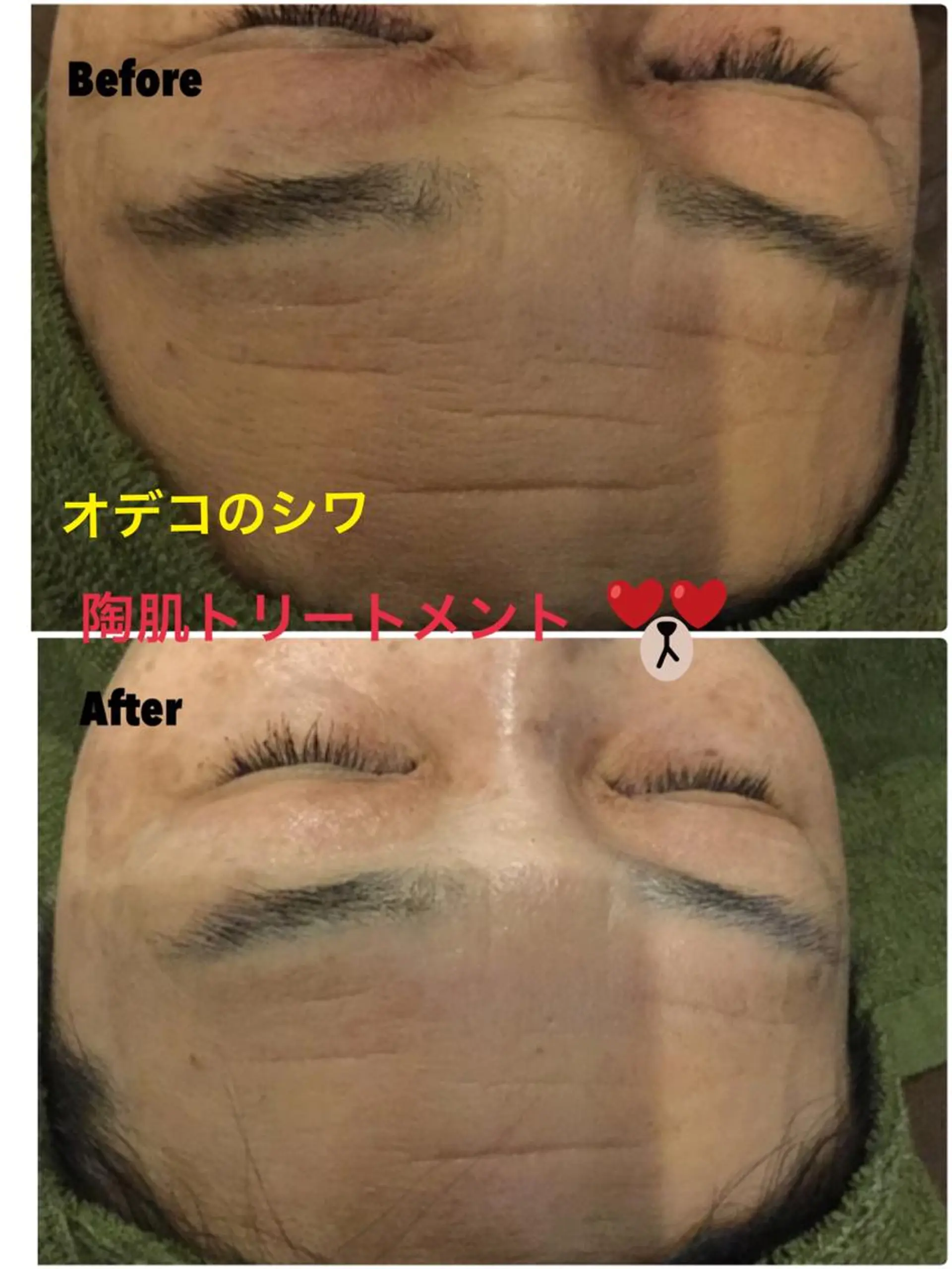 エステ 【リベルハーブピーリング認定店】敏感肌・美白脱毛専門店Dione立川店所属・Dione 立川店のエステ・リラクイメージ