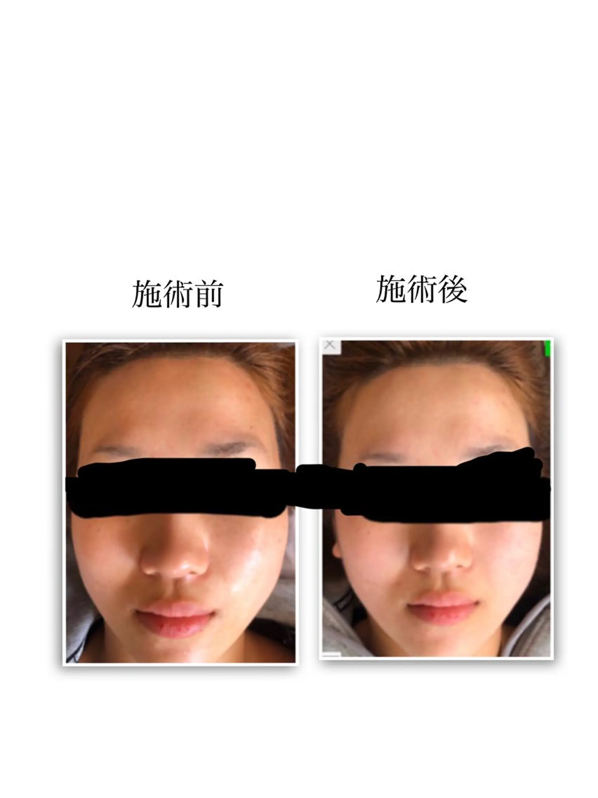 エステ 宮坂 静香のエステ・リラクイメージ