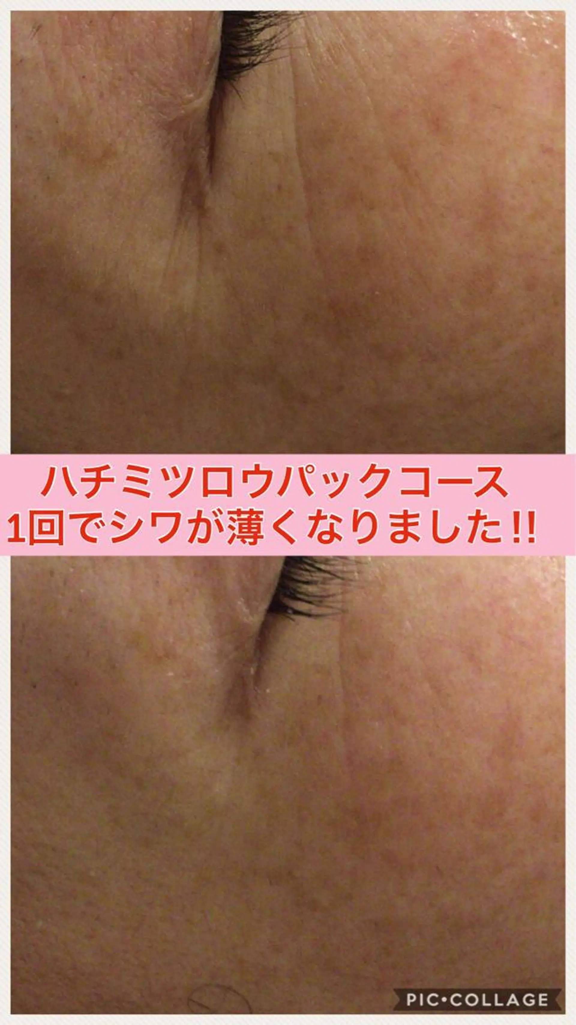 ミディアム カラー パーマ ヘアアレンジ メンズ キッズ ネイル マツエク・マツパ ニキビ・肌質改善専門 ♡人生が変わるサロンのエステ・リラクイメージ