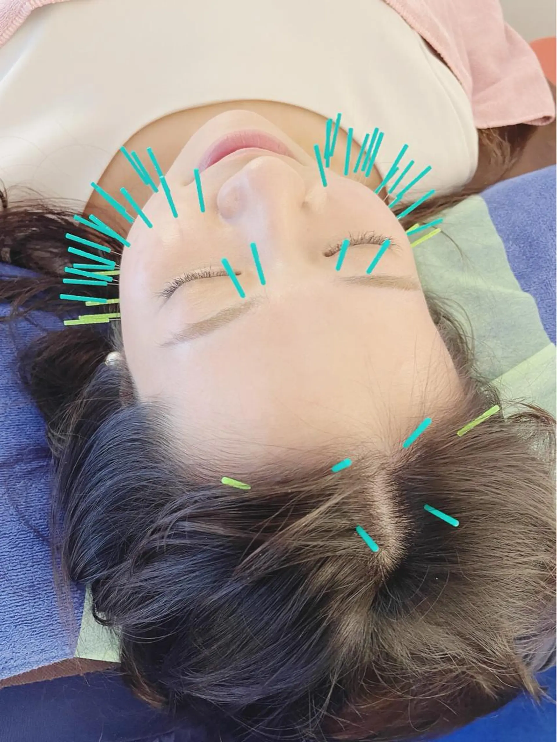 エステ リラク 小顔美容鍼専門サロン 渋谷YZのその他イメージ