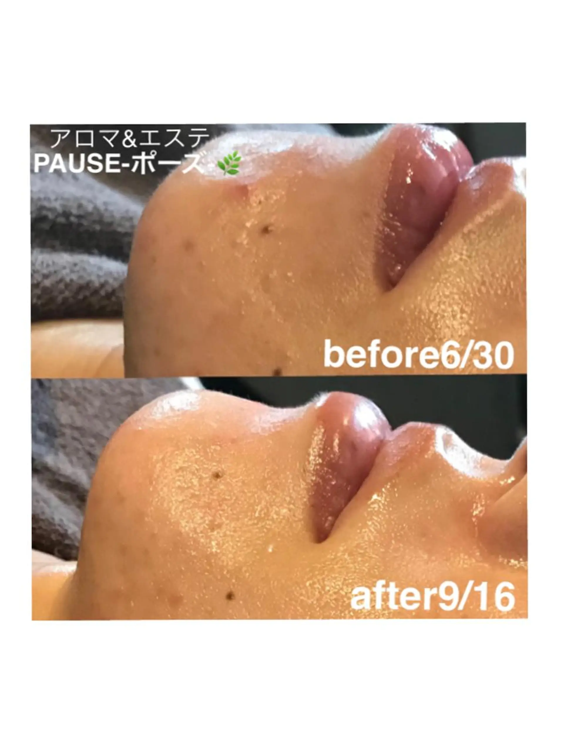 エステ 浜野 恵美のエステ・リラクイメージ