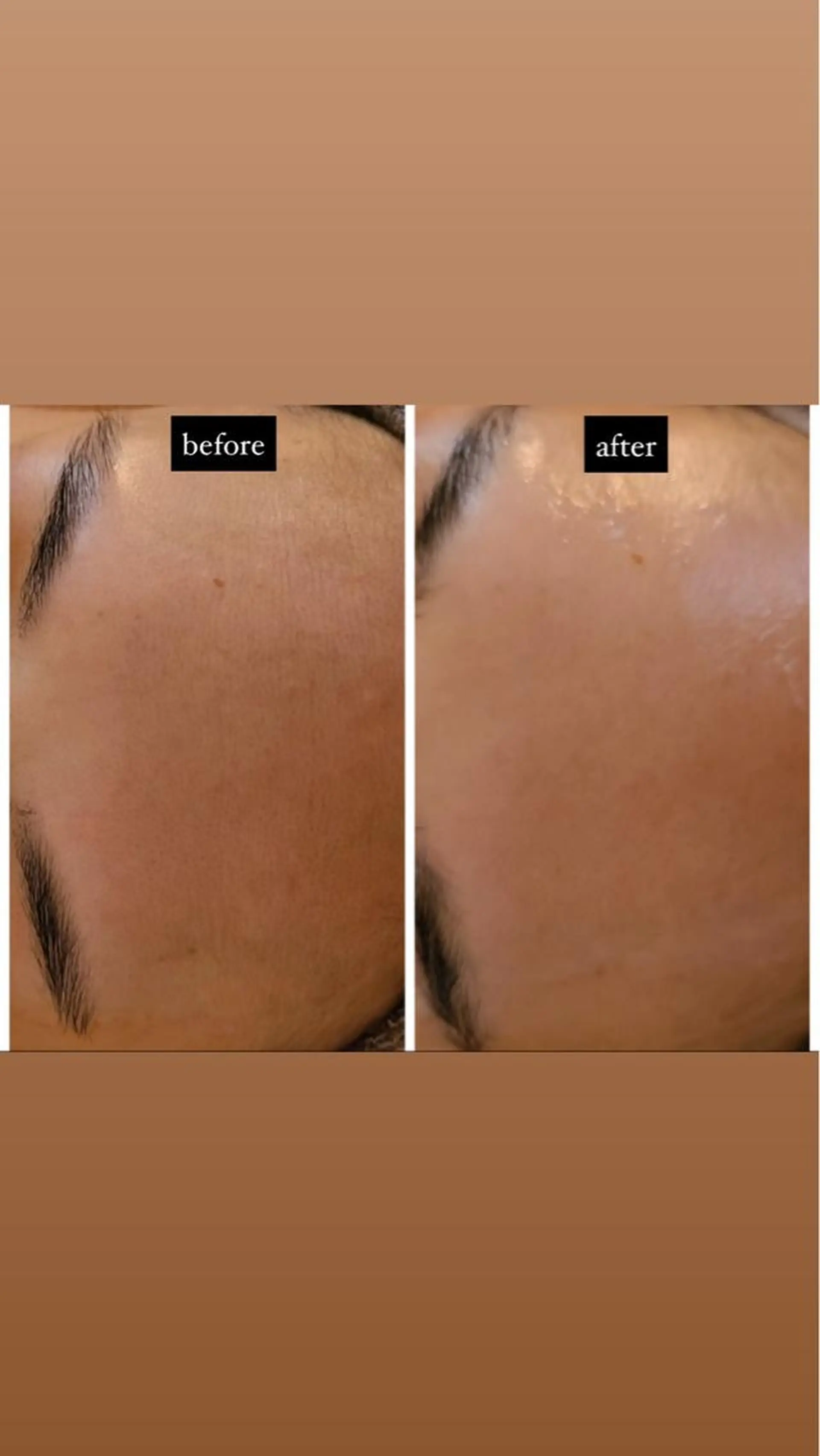 エステ リラク Luce所属・Luce Shokoのエステ・リラクイメージ