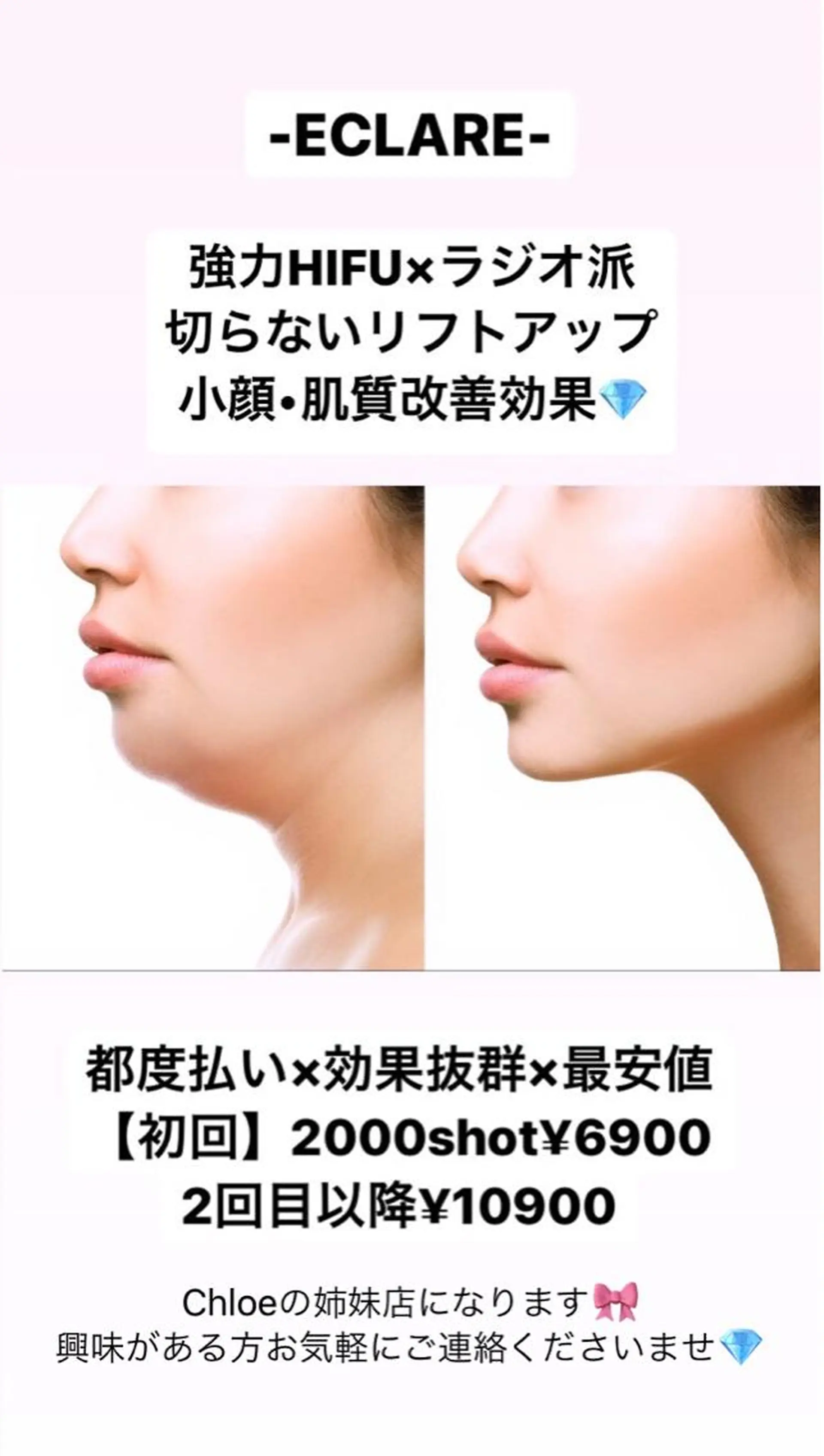 セミロング カラー パーマ ヘアアレンジ メンズ キッズ ネイル マツエク・マツパ Chloe-クロエ- 脱毛/フェイシャルのエステ・リラクイメージ