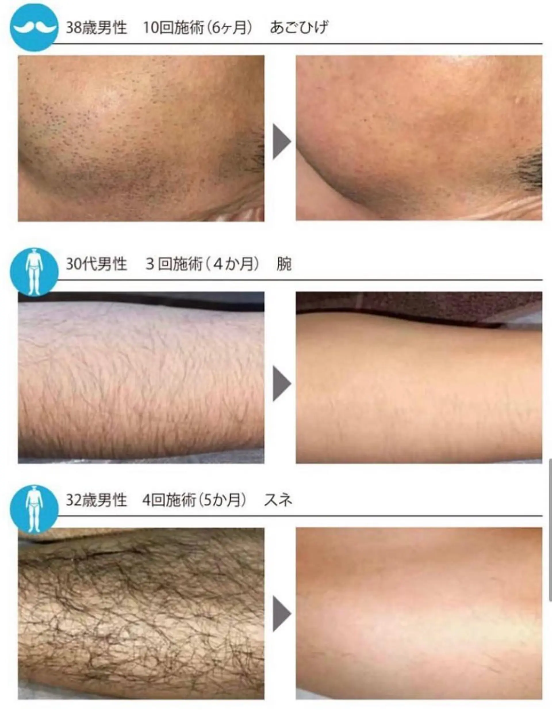 メンズ Beauty Salon Charmant所属・富山 千晶のエステ・リラクイメージ