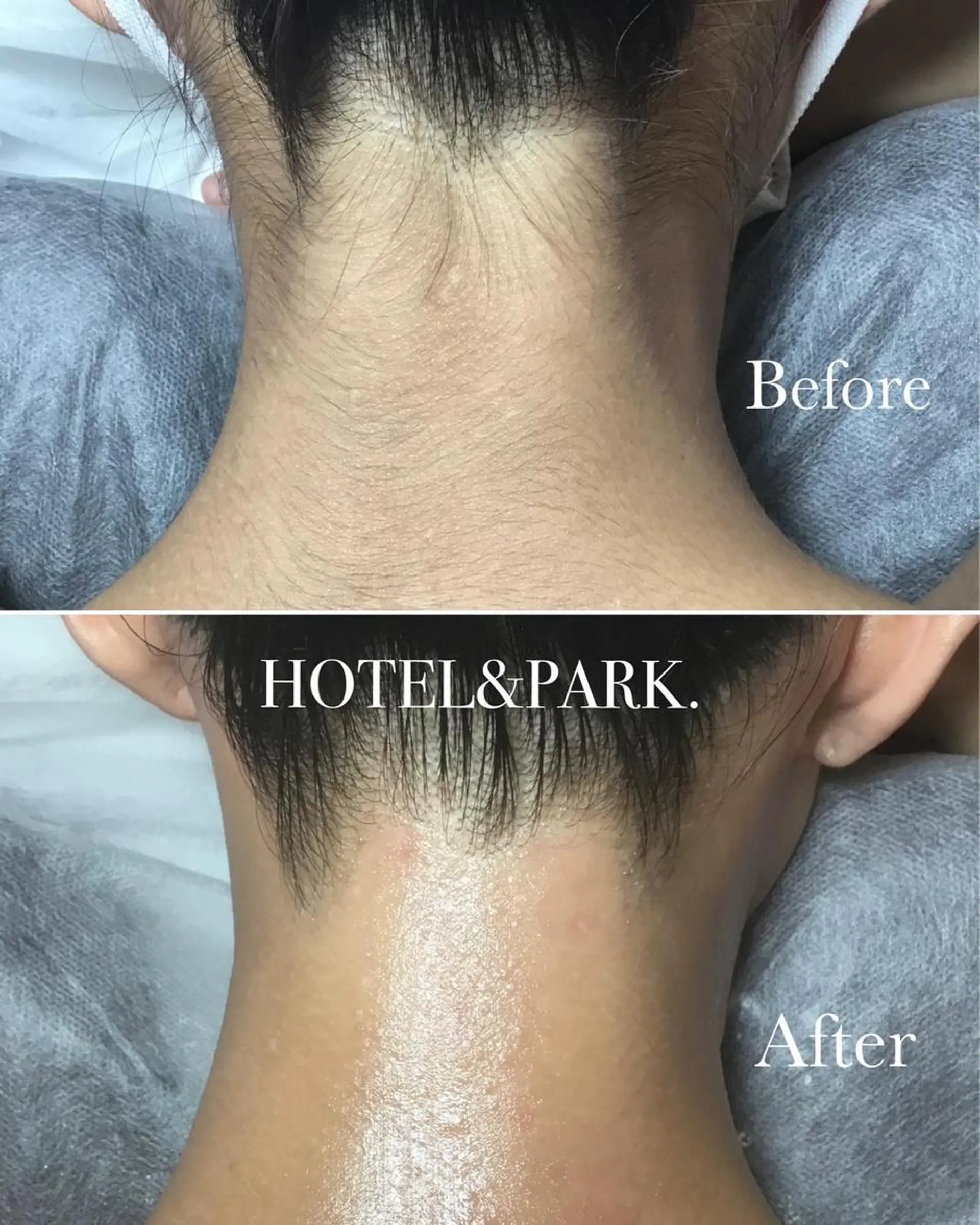 HOTEL&PARK . ワックス脱毛のエステ・リラクイメージ