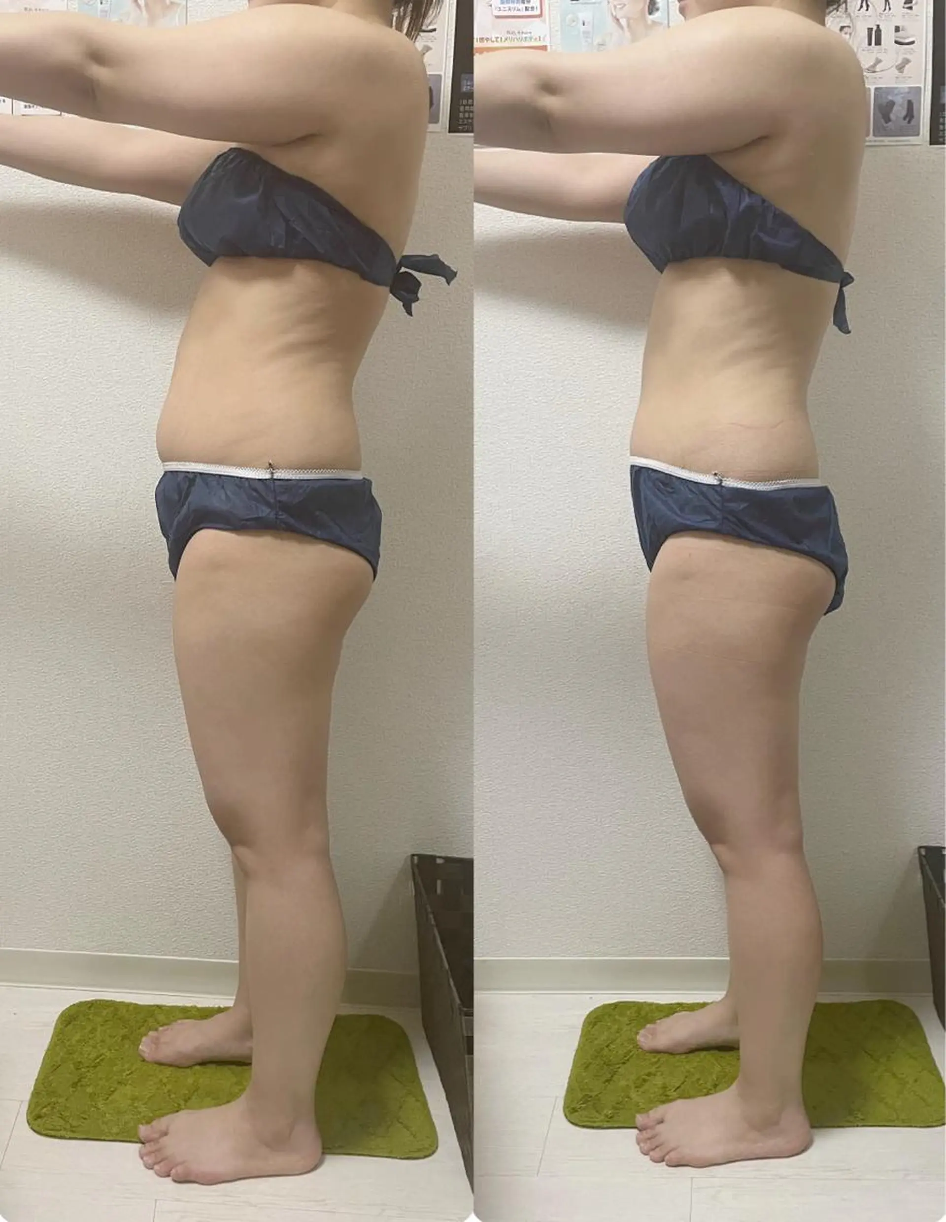 エステ 古山 由美子のその他イメージ