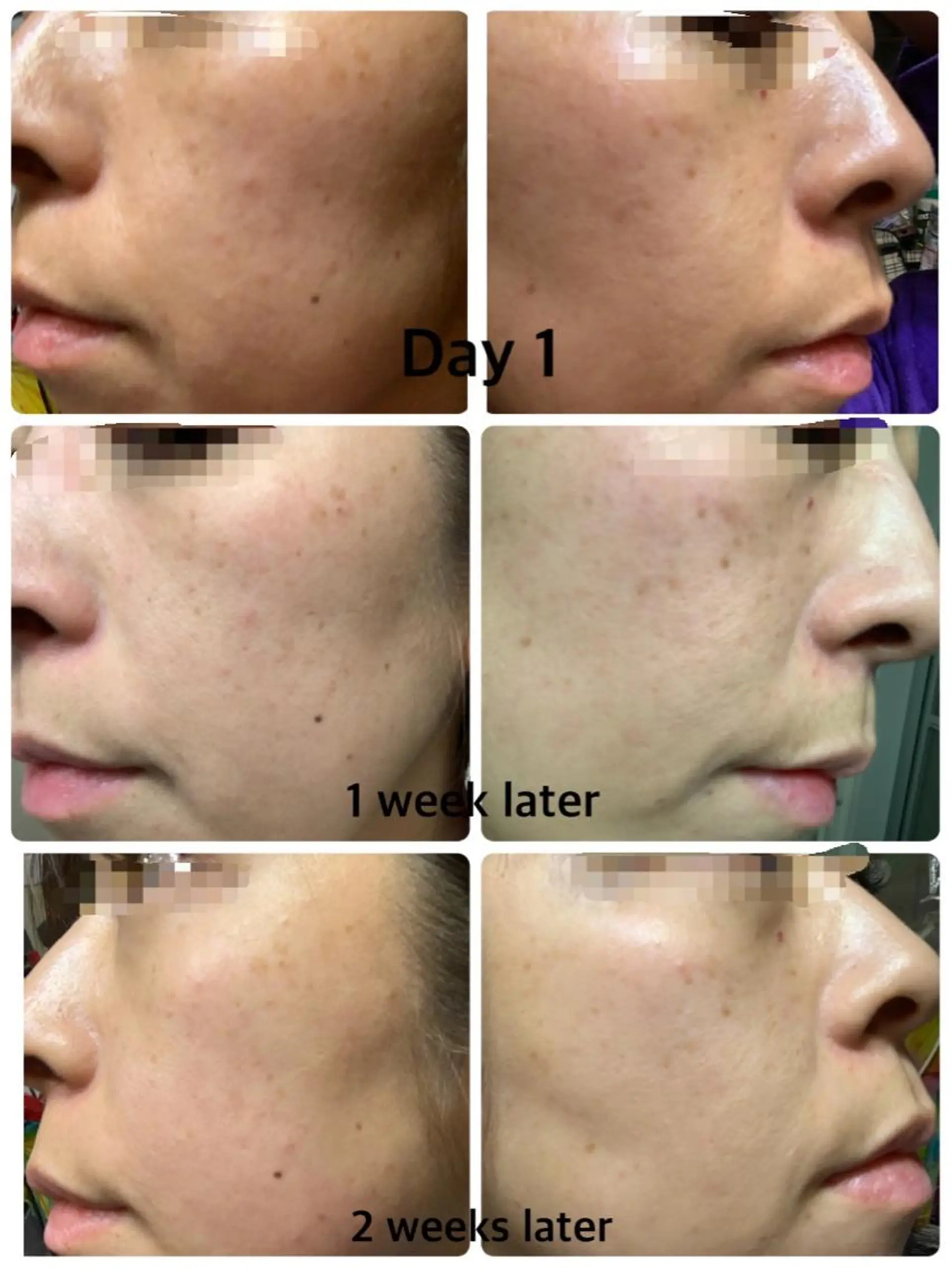 eyelist Asamiのマツエク・マツパデザイン