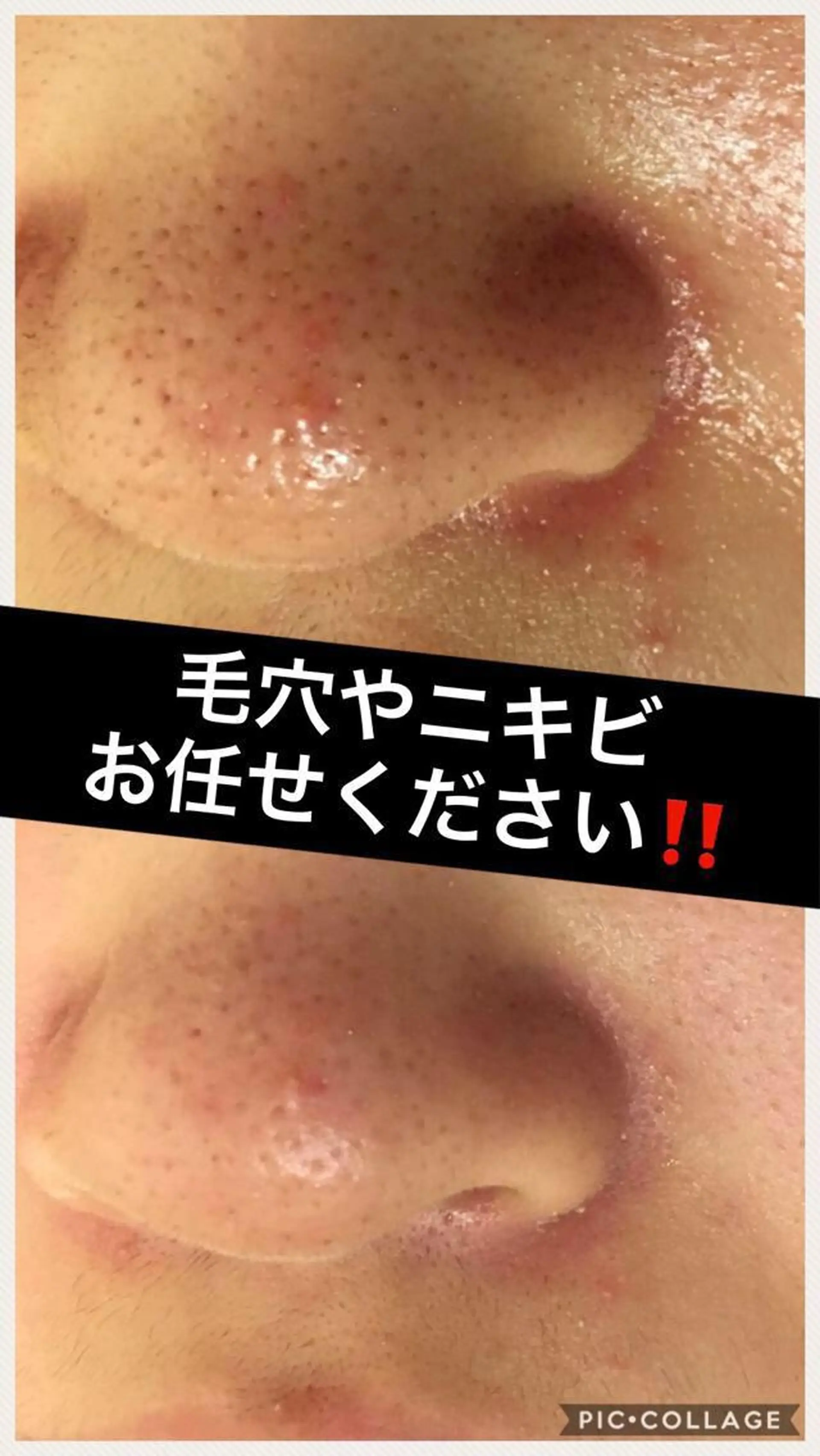 ミディアム カラー パーマ ヘアアレンジ メンズ キッズ ネイル マツエク・マツパ ニキビ・肌質改善専門 ♡人生が変わるサロンのエステ・リラクイメージ