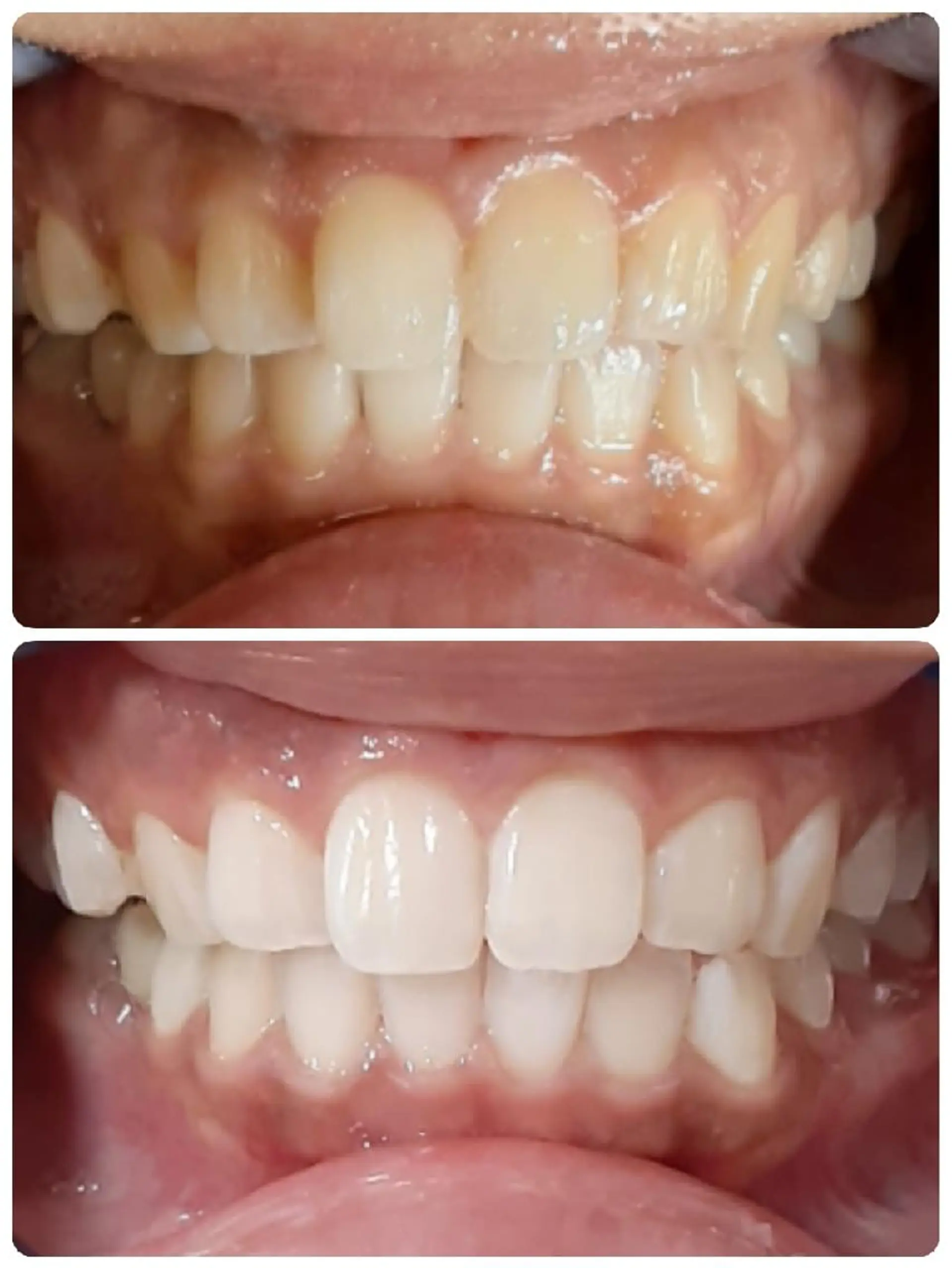 その他 五十嵐 蓮のその他イメージ