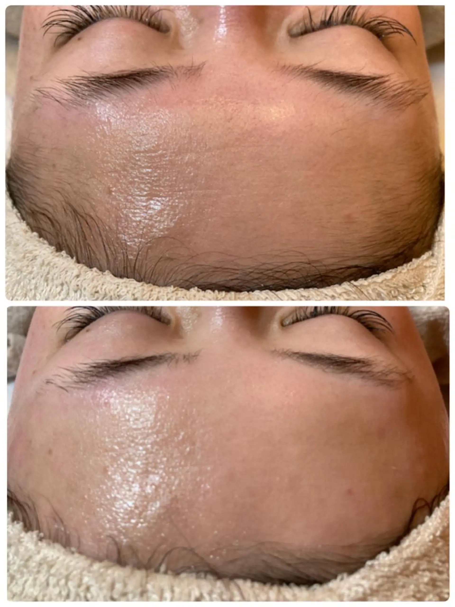 脱毛 Le cherien所属・Le cherien ルシェリアのエステ・リラクイメージ