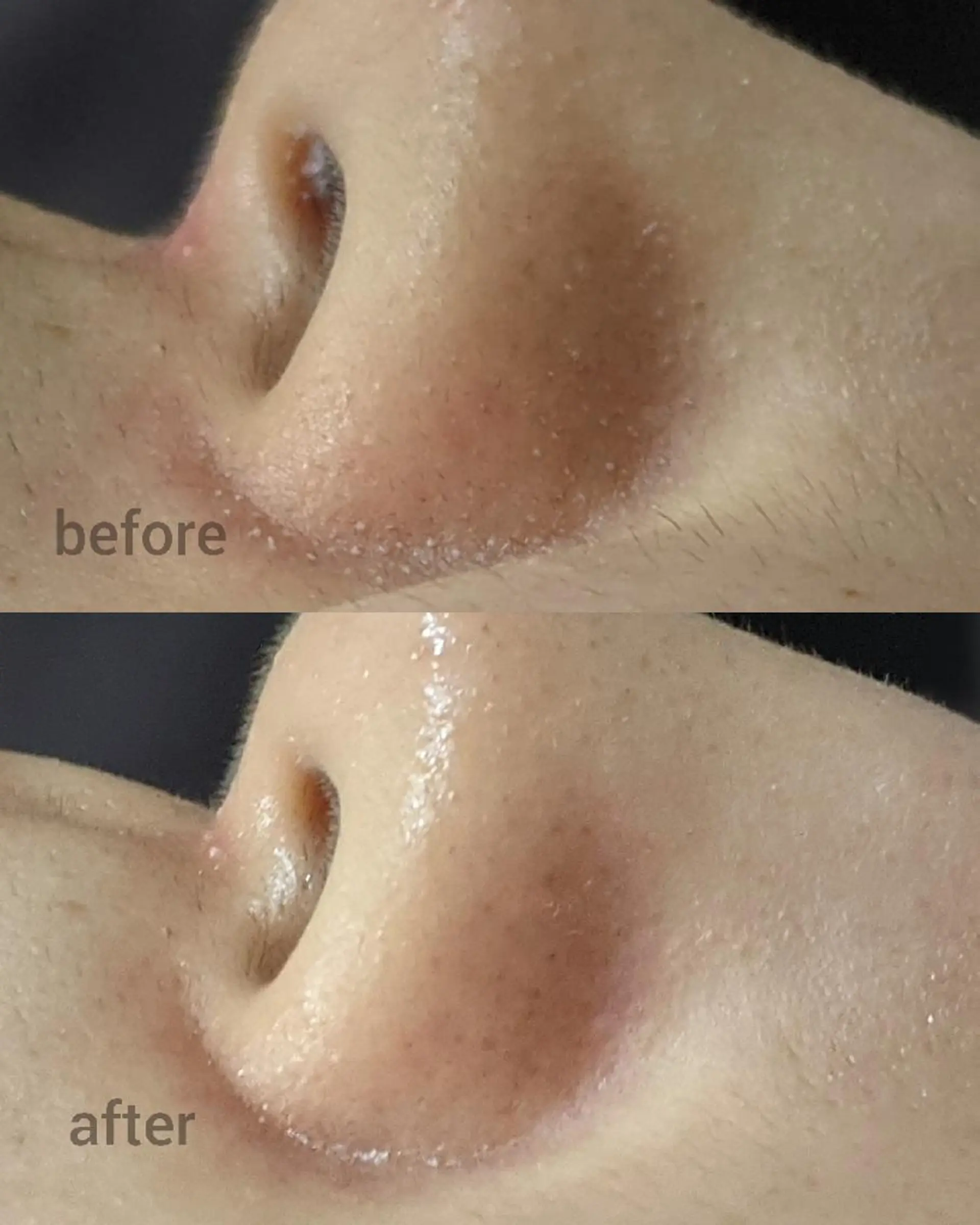 エステ 南流山 ネイルサロン グランツィア のネイルデザイン