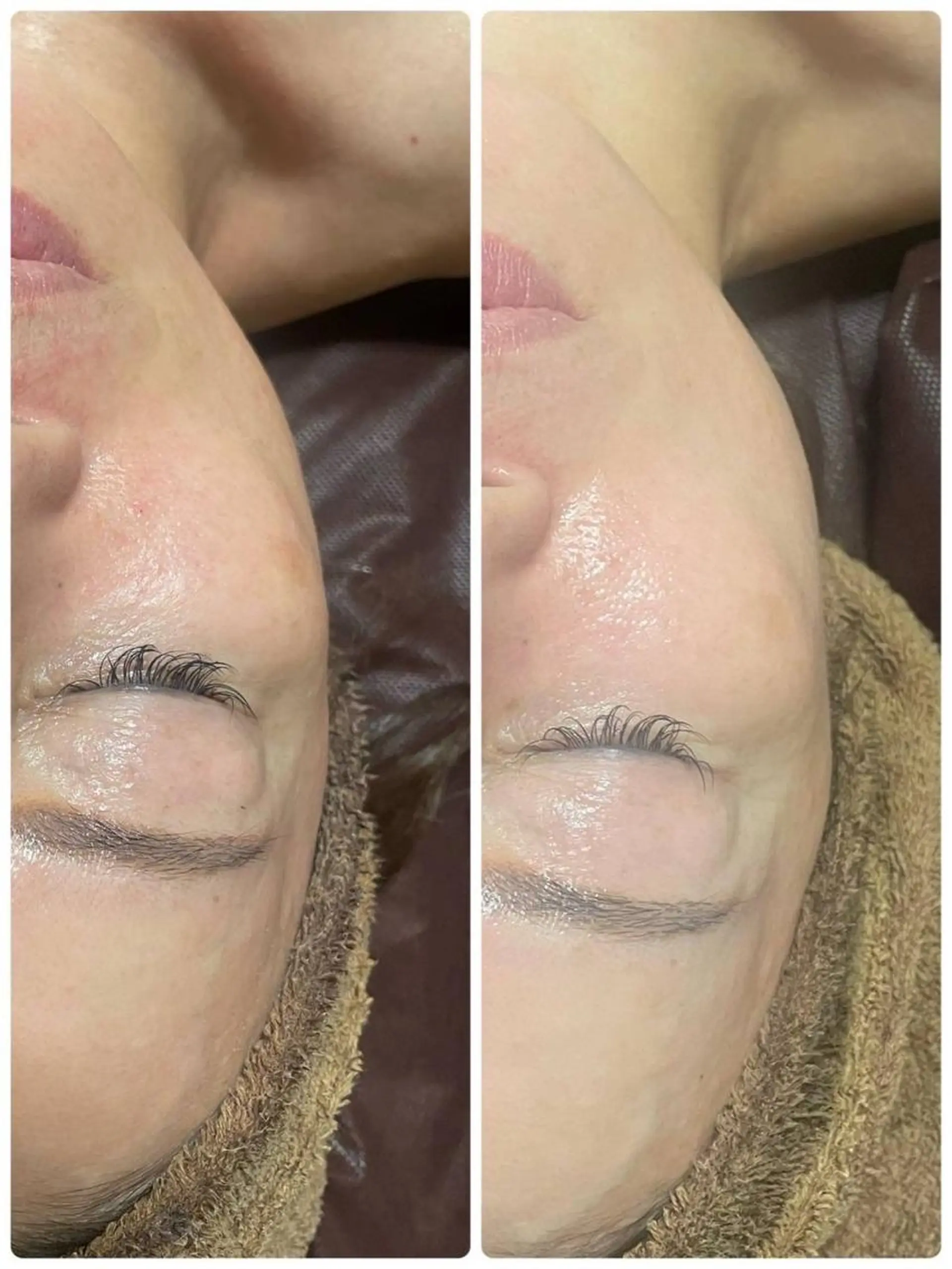 エステ Feel♡ JYURIAのネイルデザイン