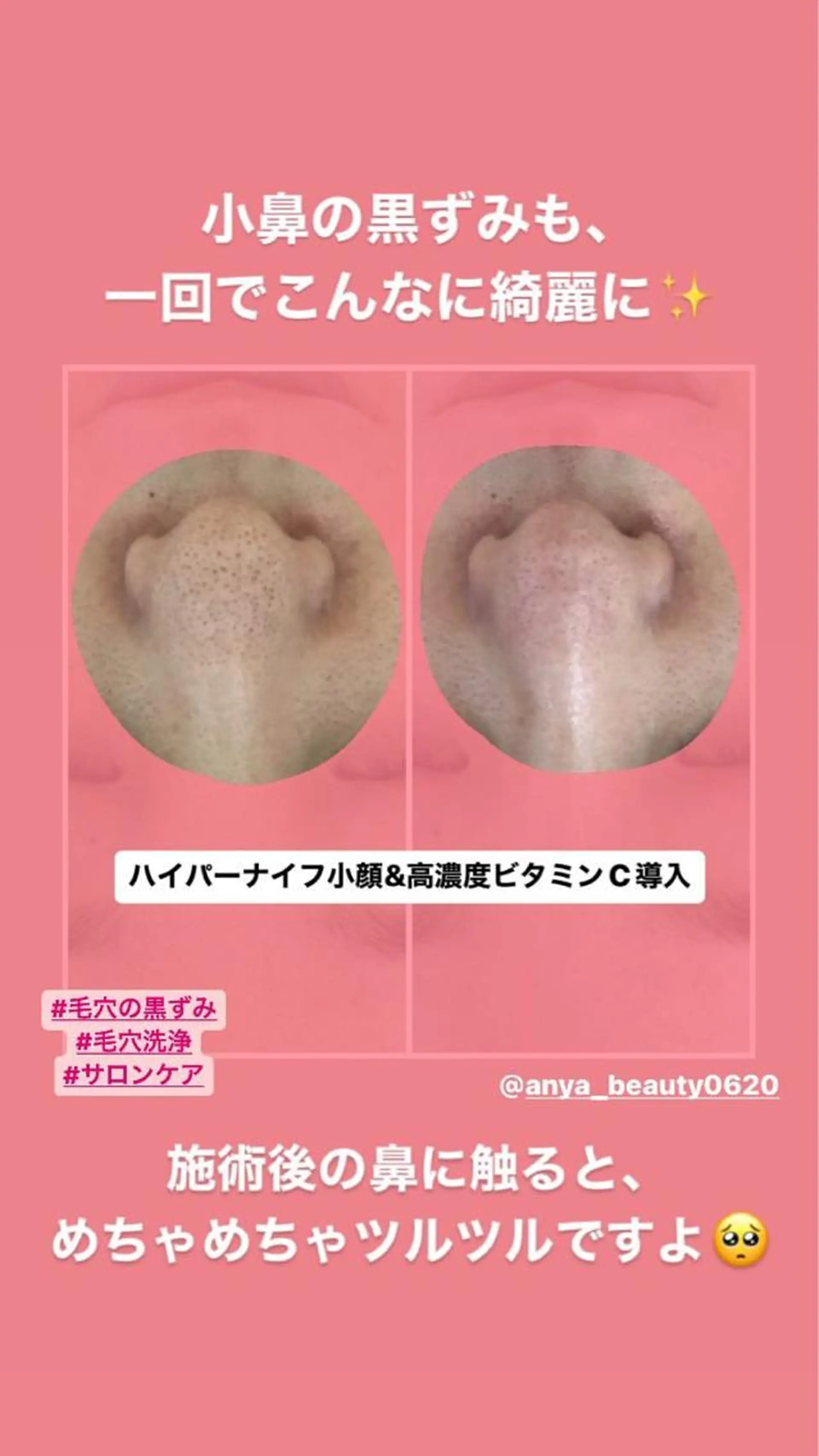 エステ Anya Beautyのエステ・リラクイメージ