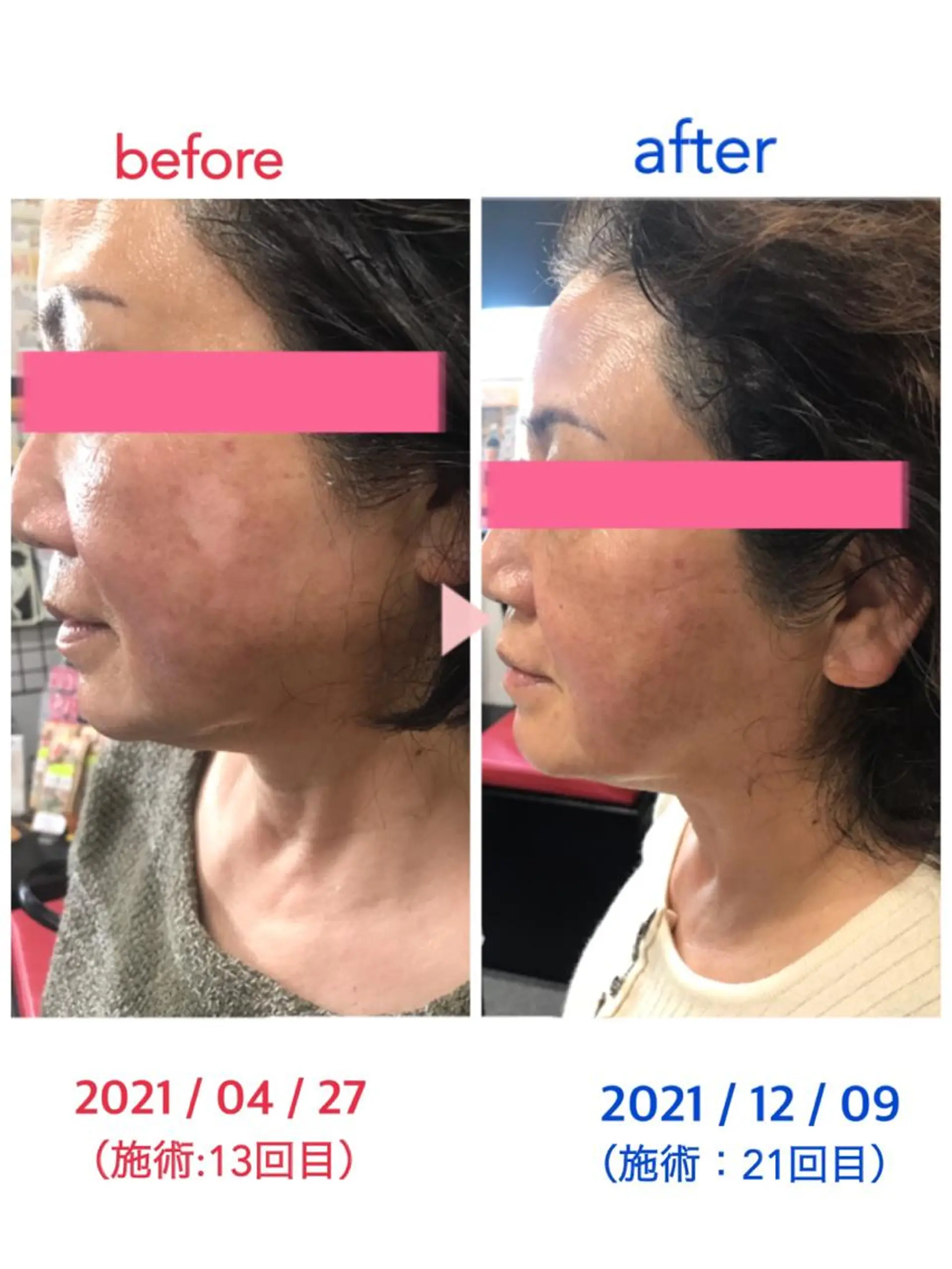 エステ みゆ漢方 薬品店のエステ・リラクイメージ