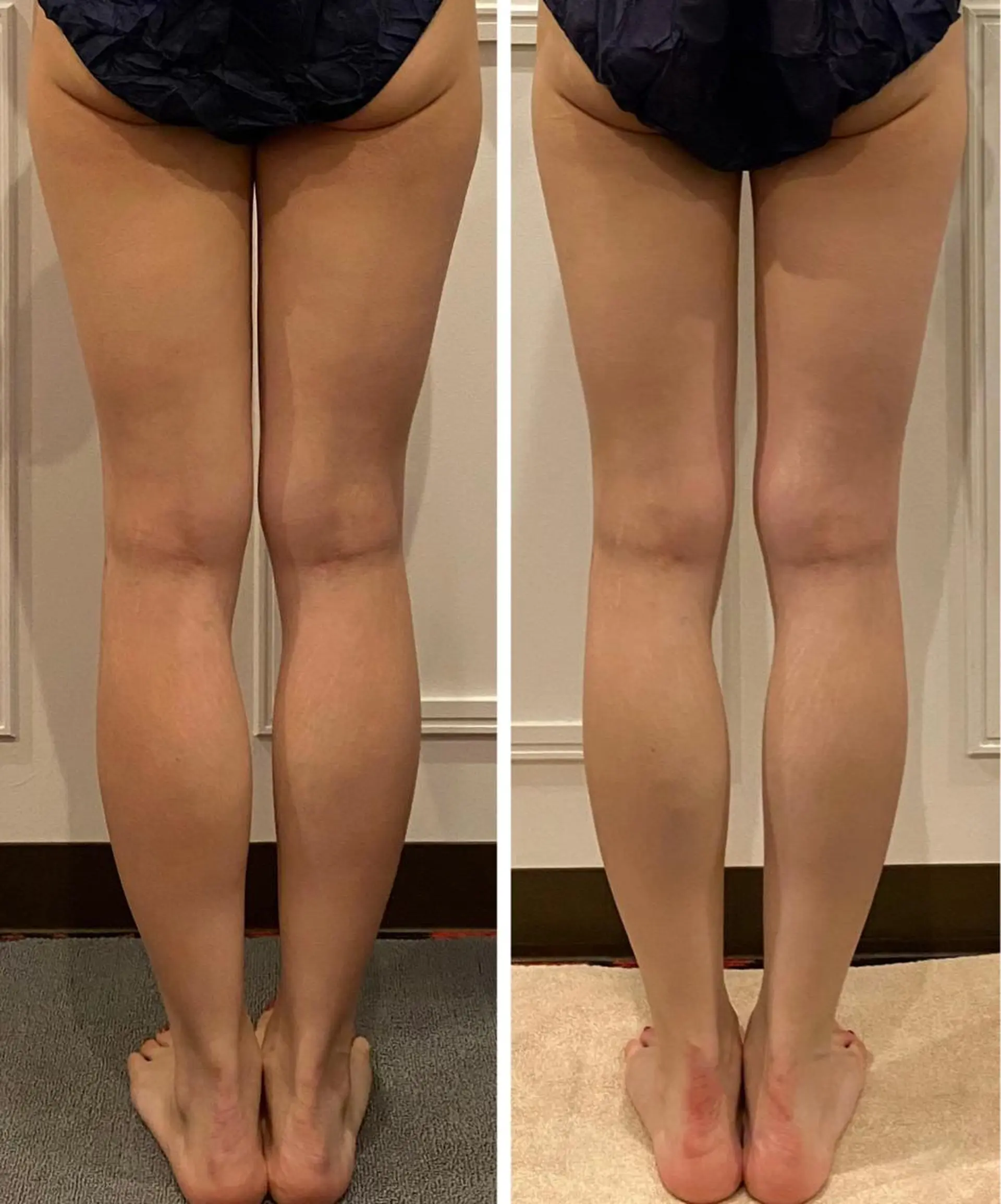 エステ リラク 通うほど変わる本格 エステ心斎橋REVIのエステ・リラクイメージ