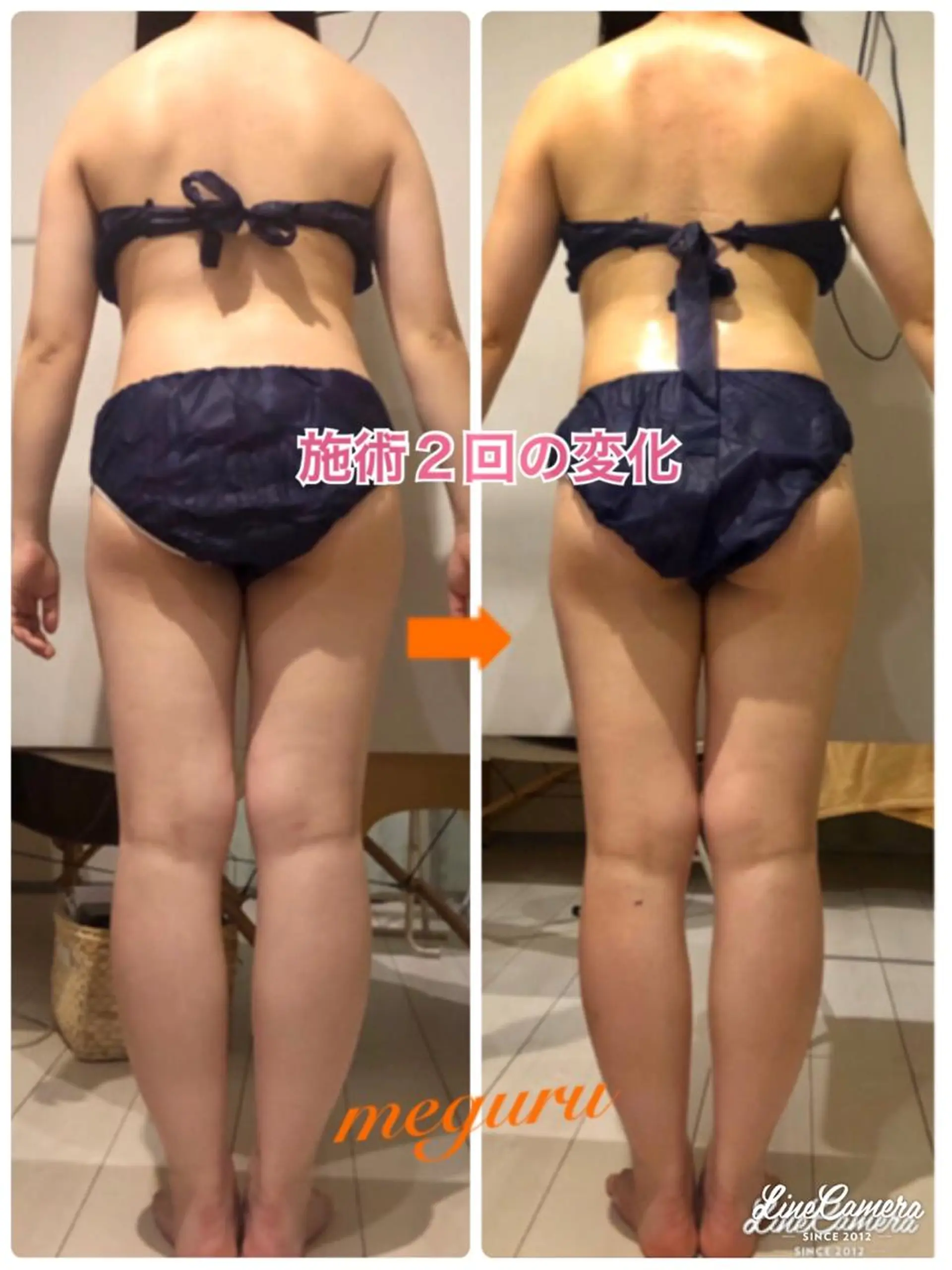 ショート カラー パーマ ヘアアレンジ メンズ キッズ ネイル マツエク・マツパ エステ リラク ‍痩身＆ボディ 結果出し🌟丹野のエステ・リラクイメージ