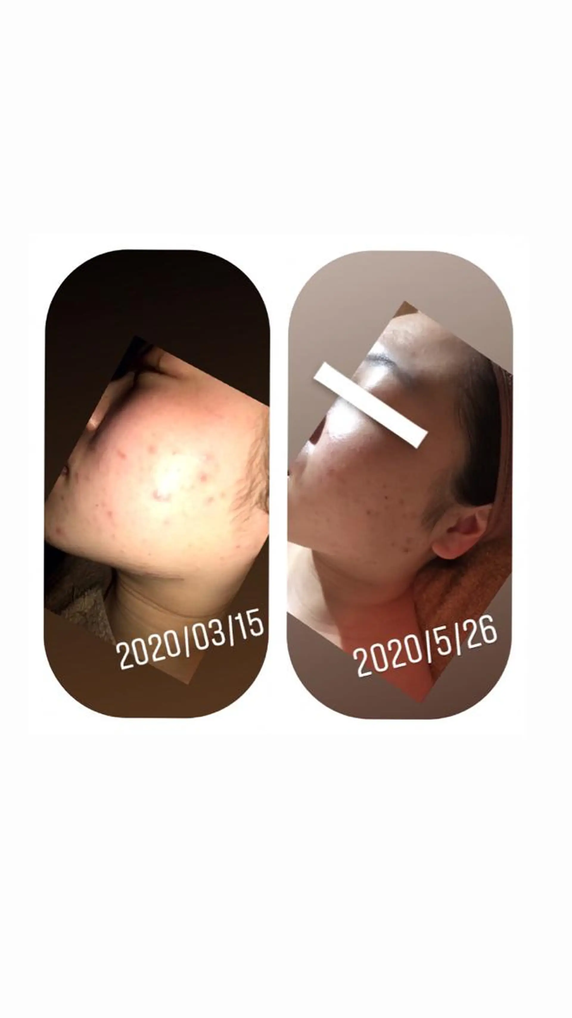 エステ 【足圧】鬼👹リンパ 身体整うサロンのエステ・リラクイメージ