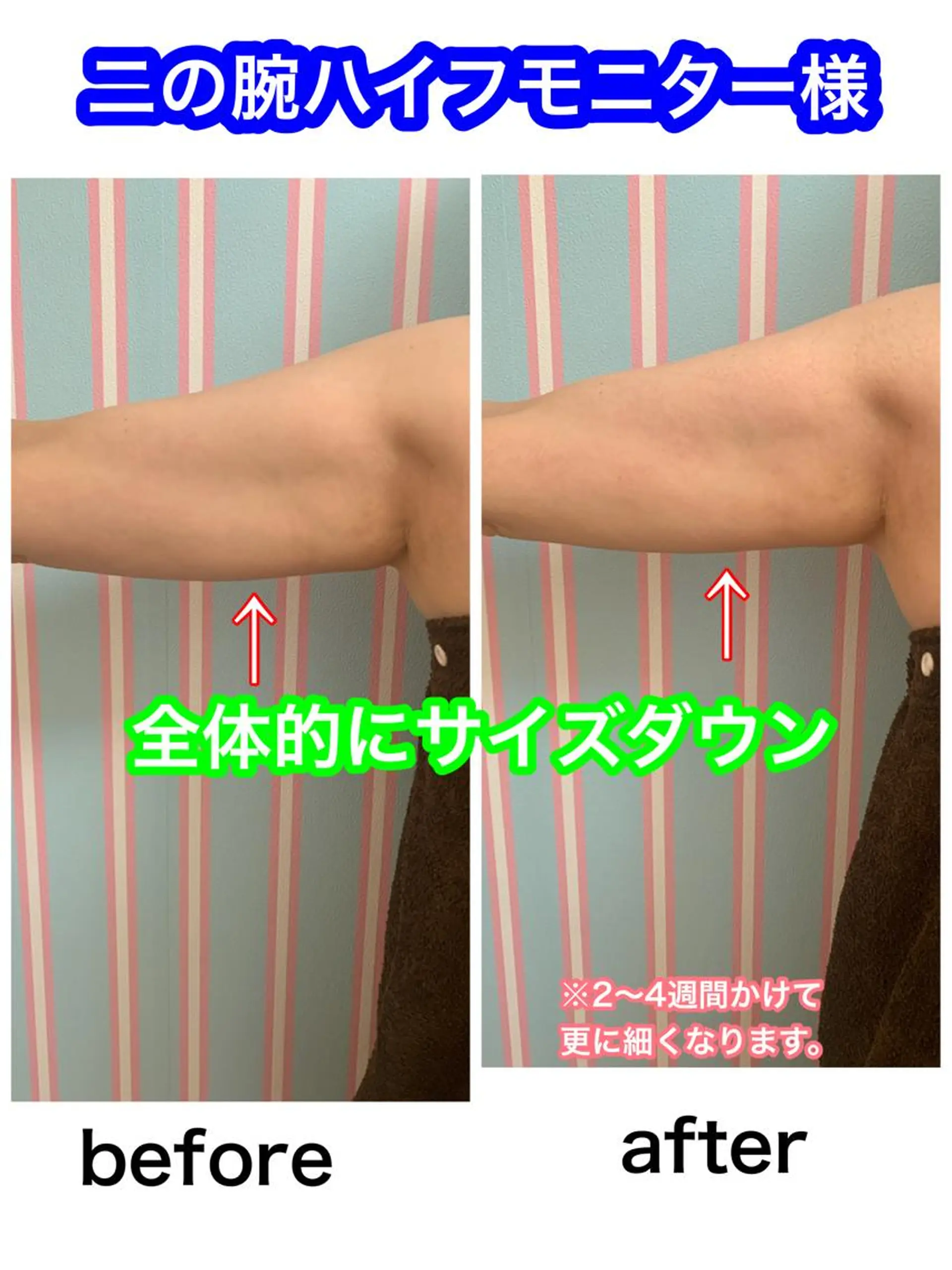 痩身/脱毛/ネイル HARUKAのエステ・リラクイメージ