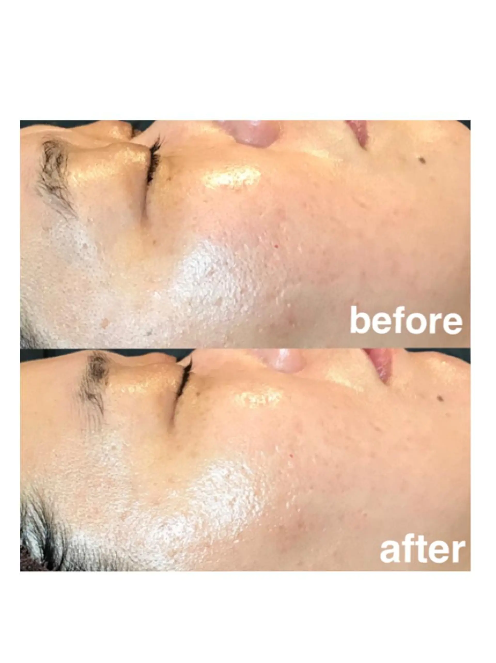 エステ 浜野 恵美のエステ・リラクイメージ