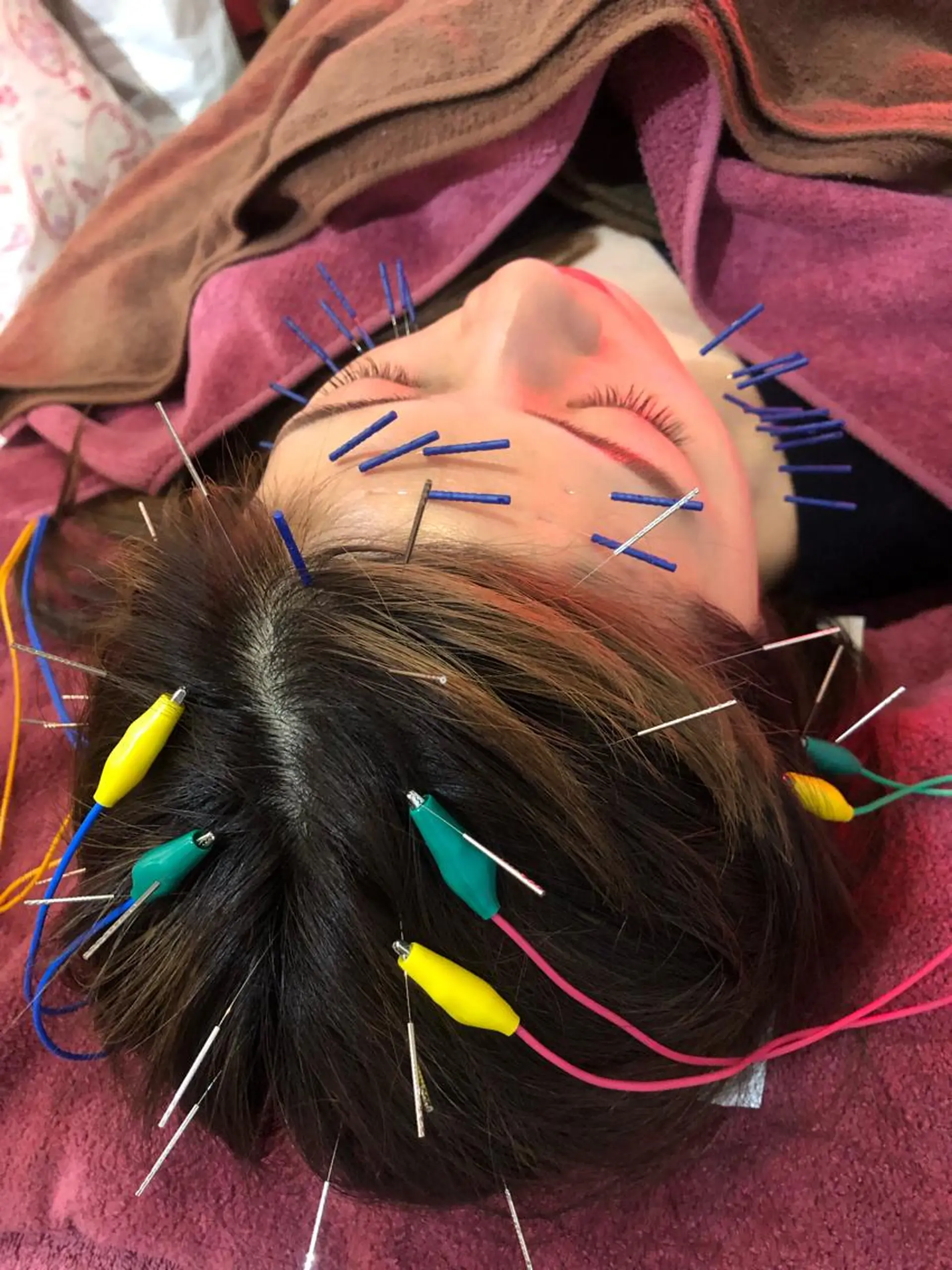 エステ リラク 美容鍼灸女性専用 りんご鍼灸治療院のエステ・リラクイメージ