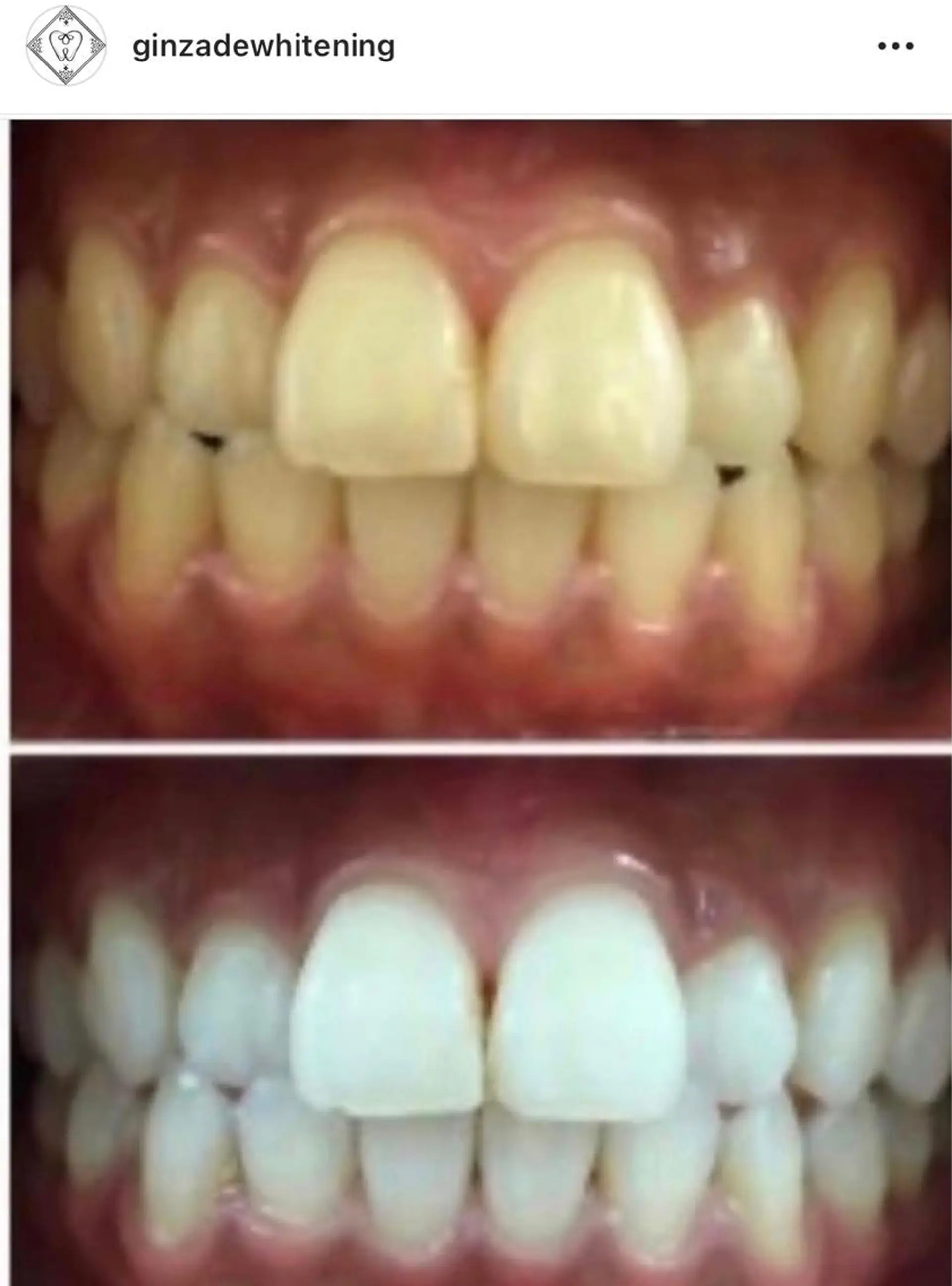 エステ リラク 銀座deホワイトニング所属・銀座de ホワイトニングのエステ・リラクイメージ