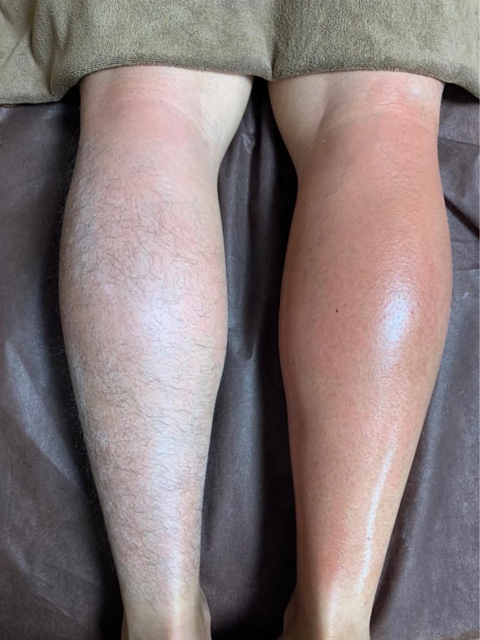 メンズ ブラジリアン☆WAX 🎖🌚YUKI🌚のエステ・リラクイメージ