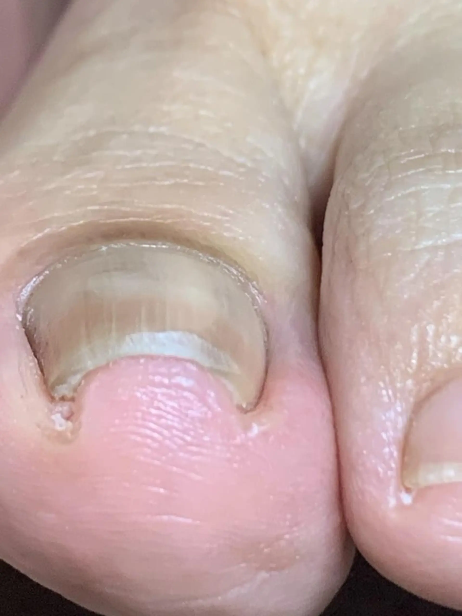 その他 carenail　 tsugumiのその他イメージ