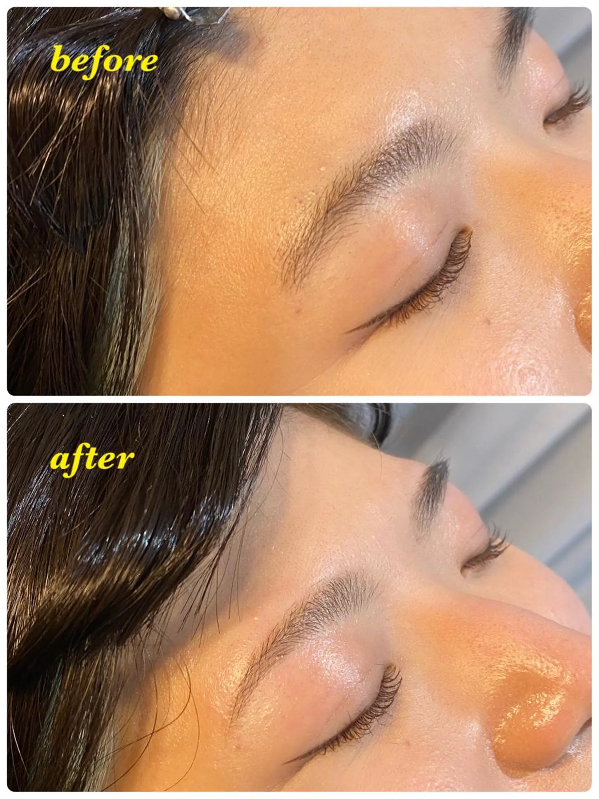 アイブロウ ハーブピーリング/韓国肌管理/フェイシャル/毛穴洗浄/眉毛/顔脱毛【糸脱毛専門】rev所属・ハーブピーリング🌹 毛穴洗浄❤️眉waxのエステ・リラクイメージ