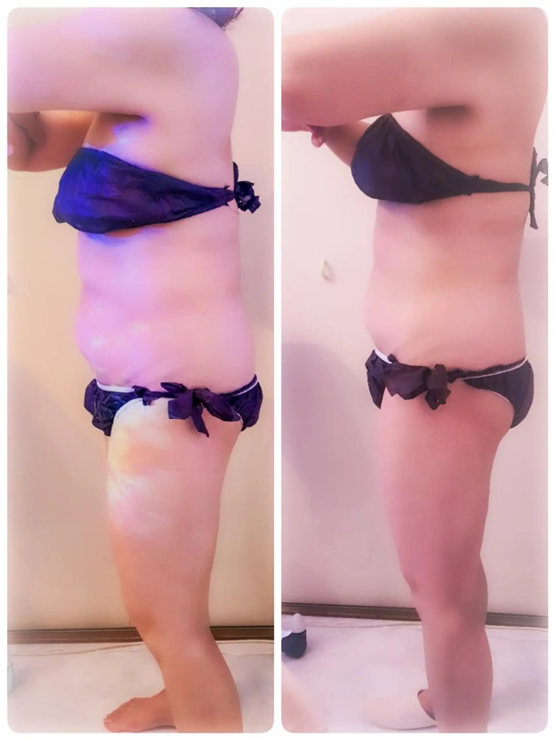 痩身ハーブピーリング 筋膜リリース☆B&Hのエステ・リラクイメージ