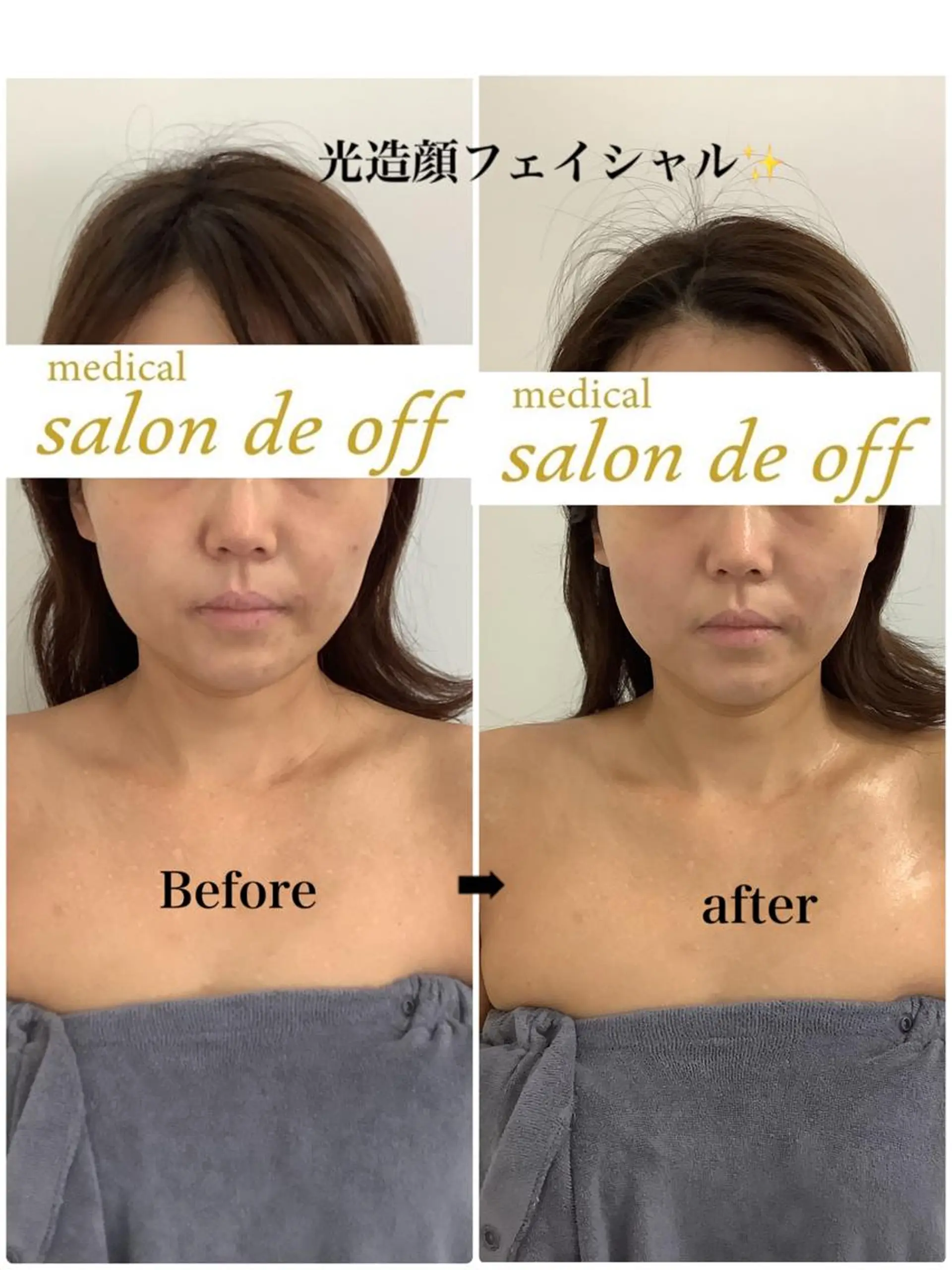 🩵Tatsumi Kana🩵のエステ・リラクイメージ