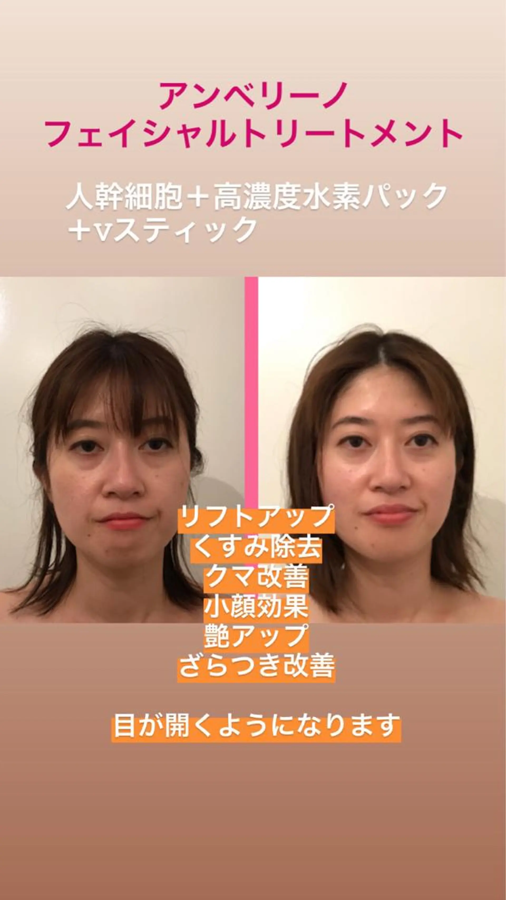 山戸雅代 ~θTHETA~のエステ・リラクイメージ