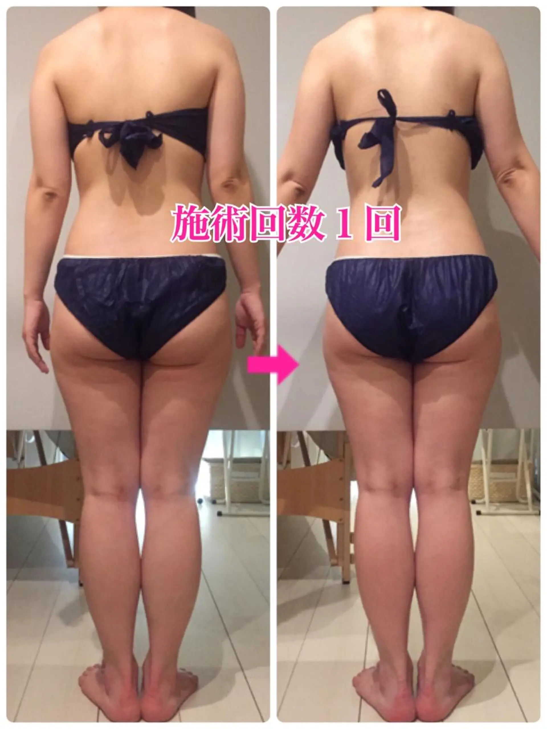 ロング カラー パーマ ヘアアレンジ メンズ キッズ ネイル マツエク・マツパ ‍痩身＆ボディ 結果出し🌟丹野のエステ・リラクイメージ