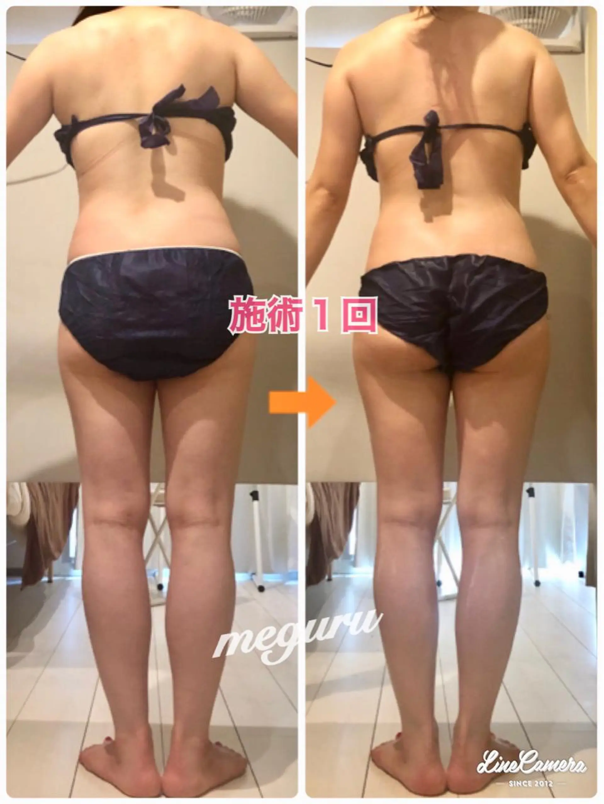 ショート カラー パーマ ヘアアレンジ メンズ キッズ ネイル マツエク・マツパ ‍痩身＆ボディ 結果出し🌟丹野のエステ・リラクイメージ