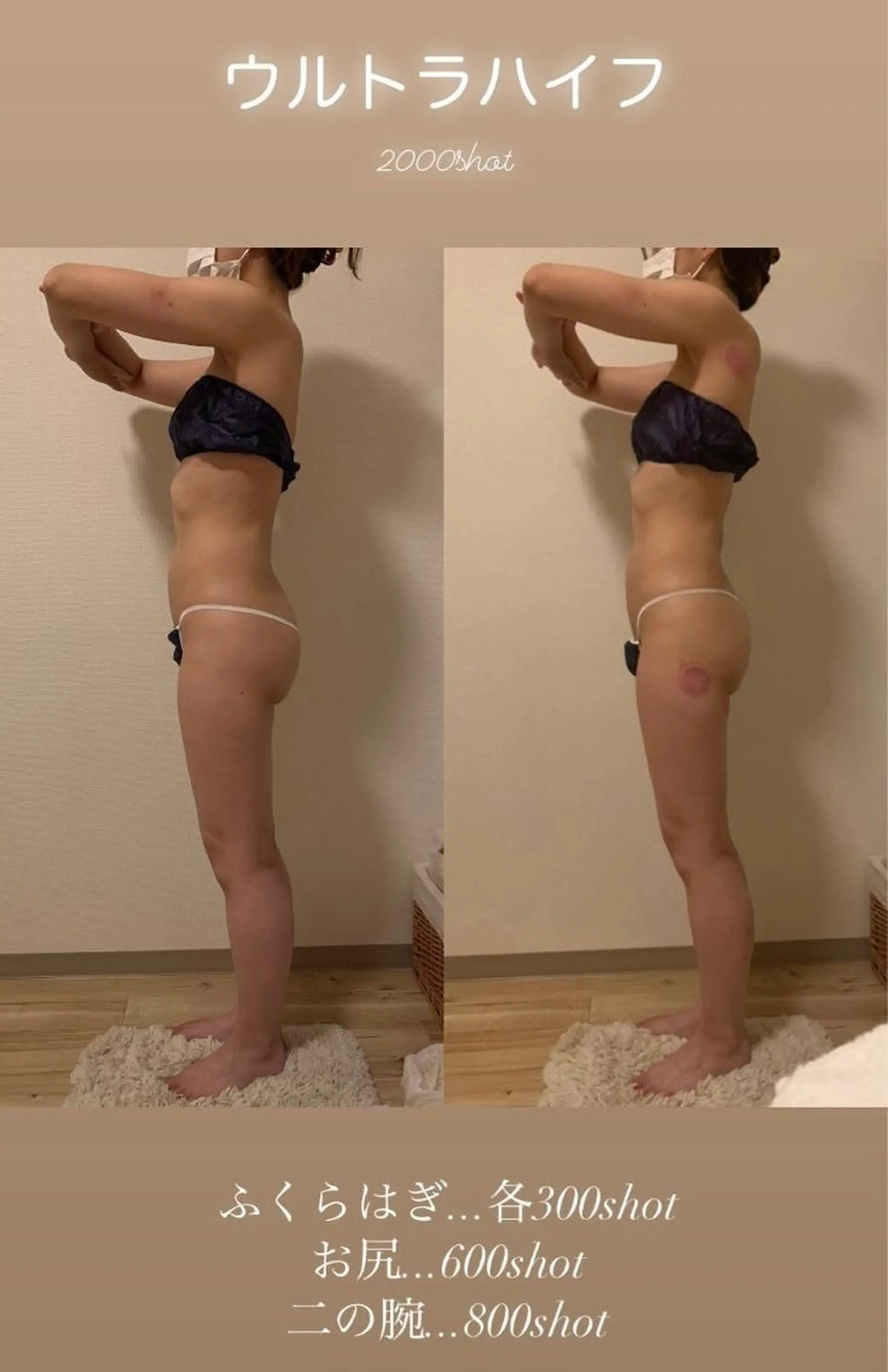 a  room salonのエステ・リラクイメージ