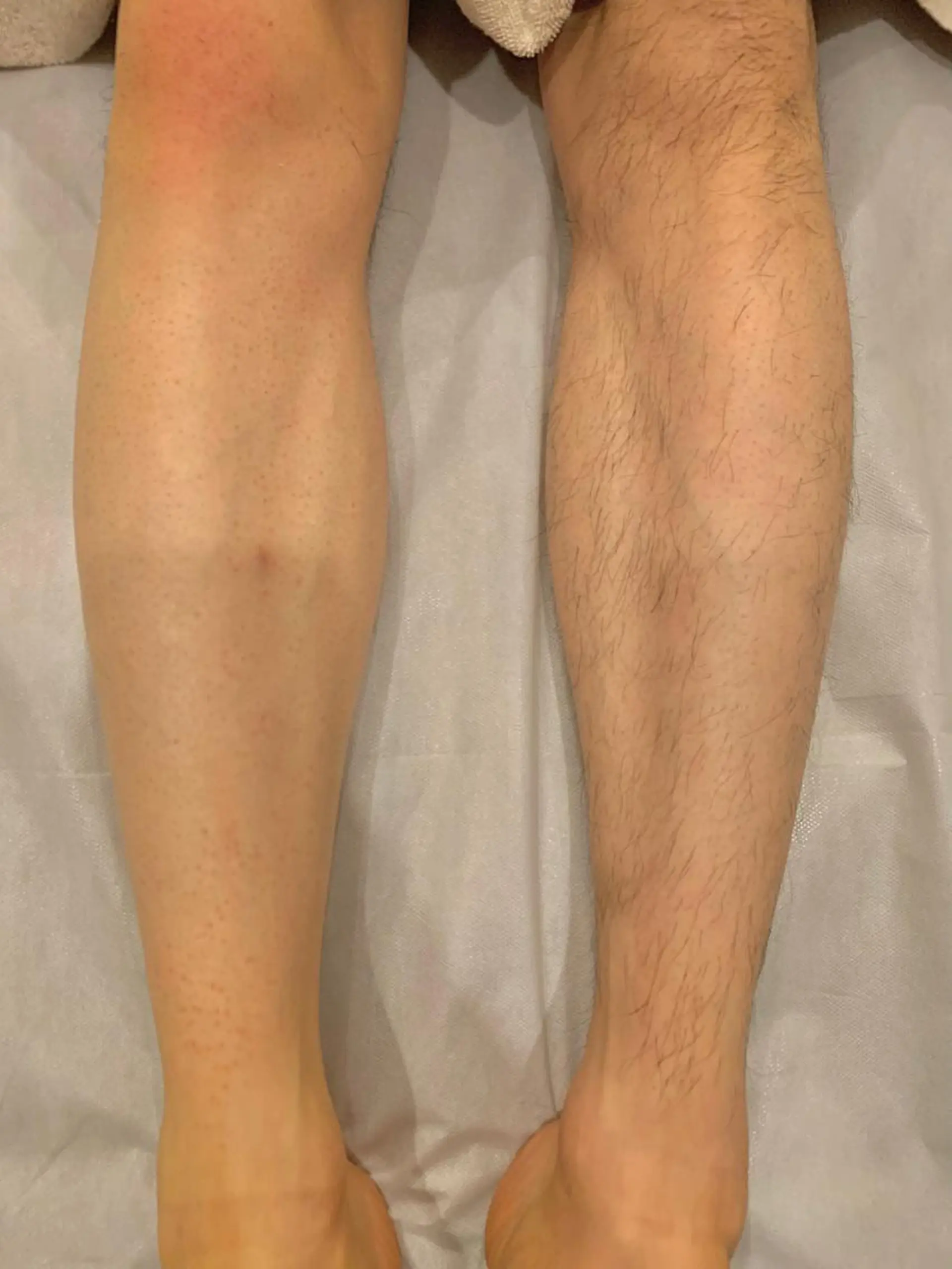 脱毛 Hisui 山本のエステ・リラクイメージ