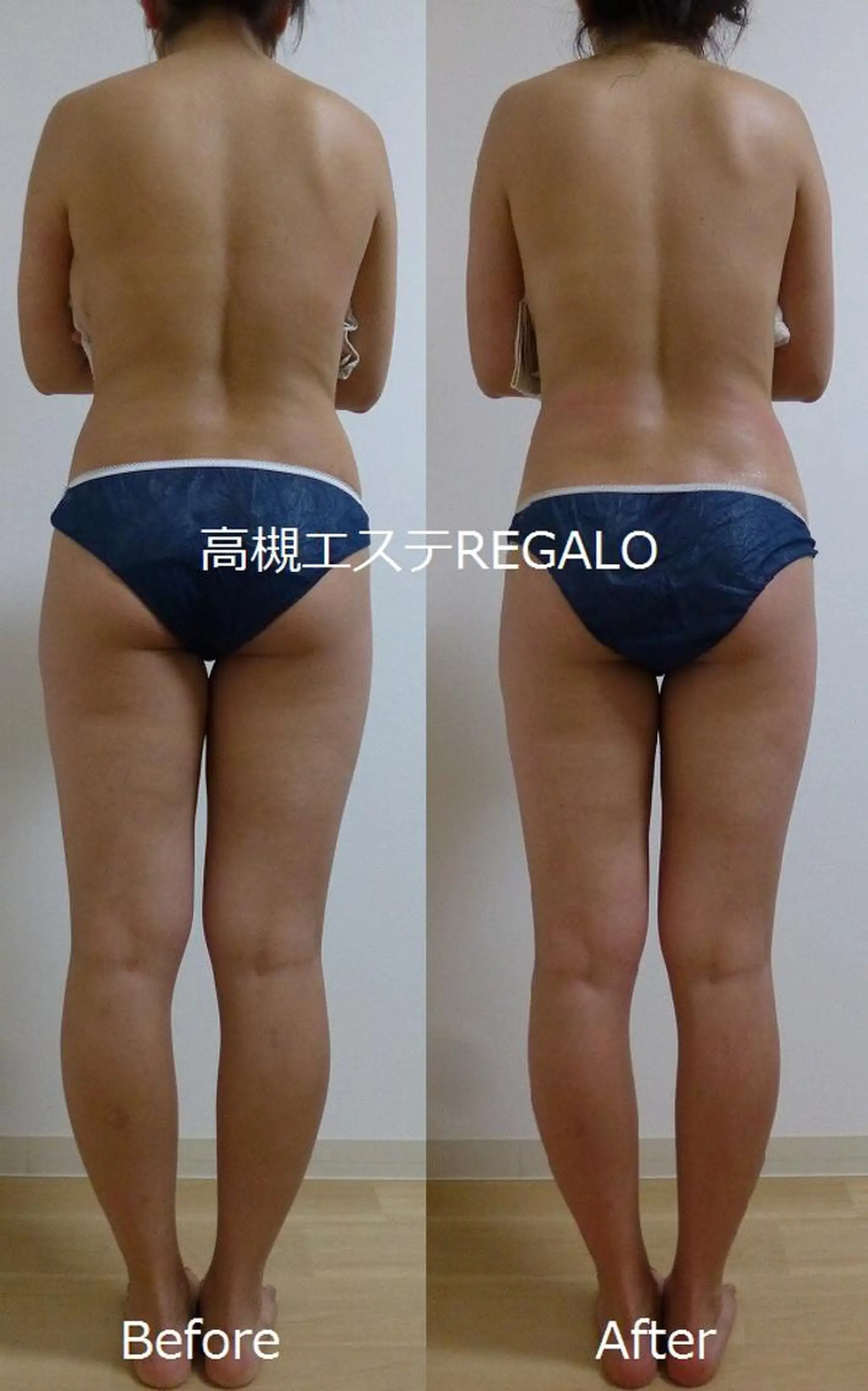 REGALO所属・矢野 さやかのエステ・リラクイメージ