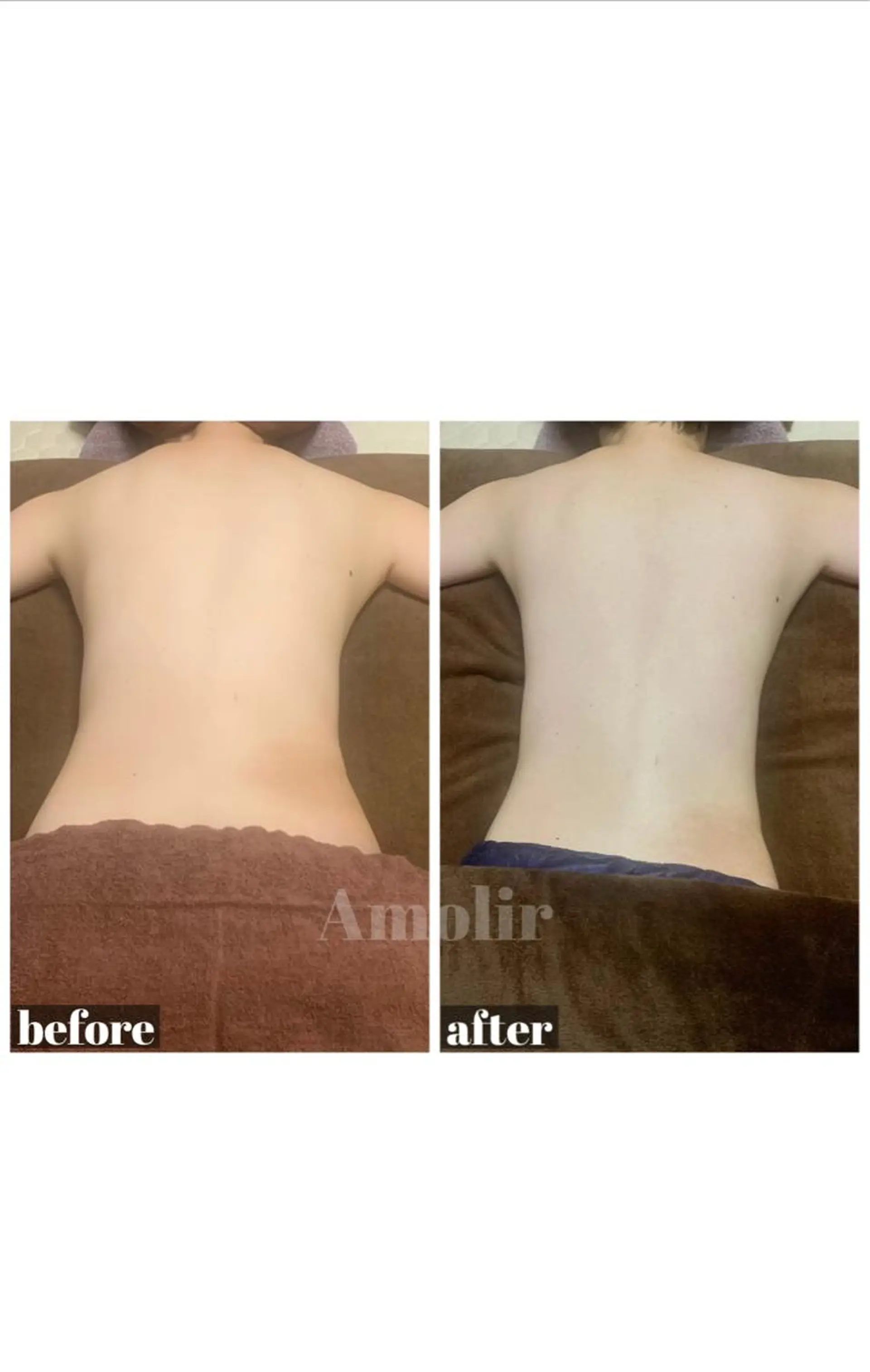 30代以降のボディ メイク Amolirのエステ・リラクイメージ